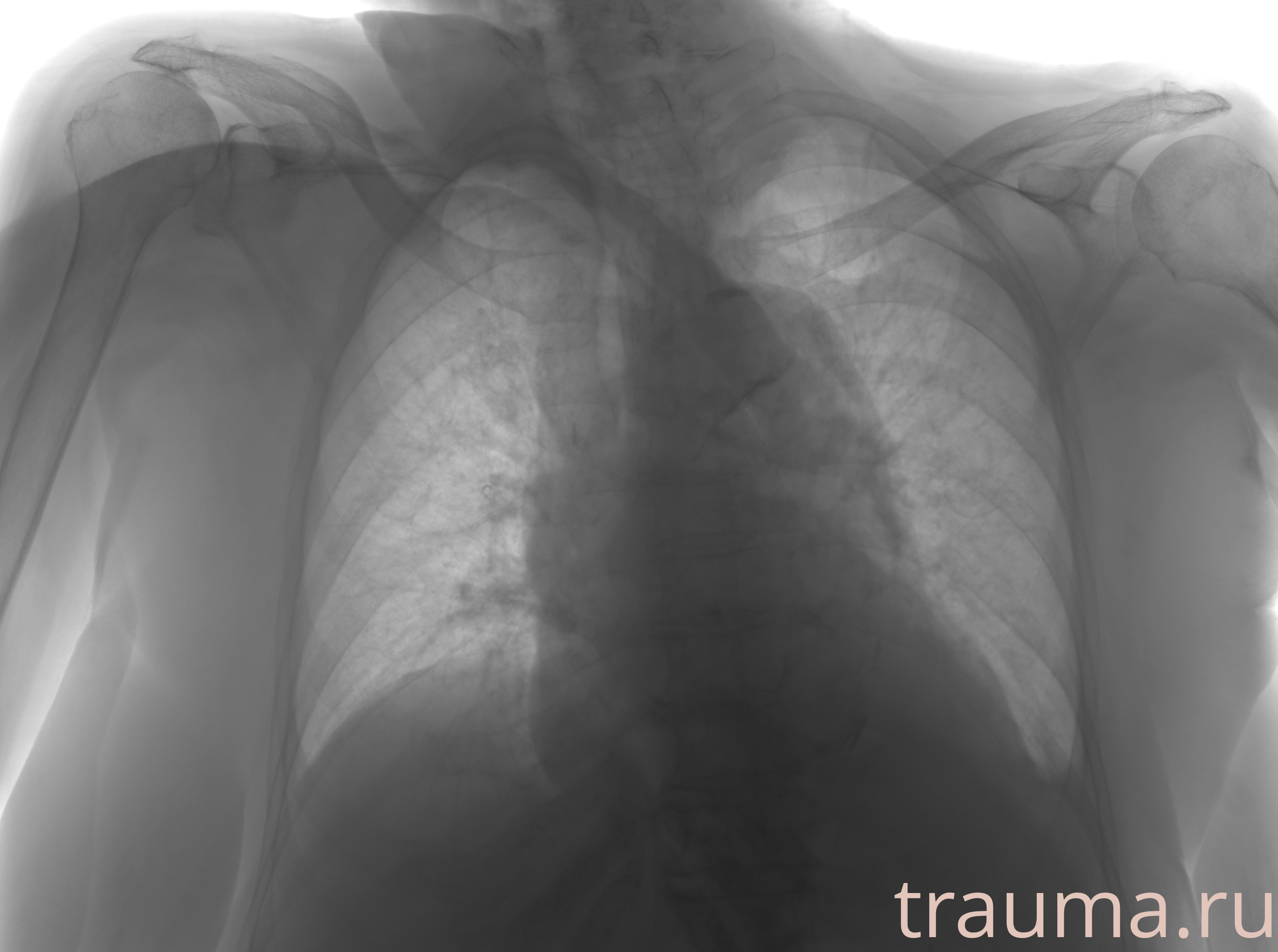 Рентген на дому: по вашему адресу приезжает врач-рентгенолог, травматолог-ортопед с мобильным рентгеновским аппаратом, проводит диагностику травмы или заболевания, делает необходимые рентгенограммы, дает рекомендации по дальнейшему лечению. Получить качественные снимки в домашних условиях возможно благодаря уникальной методике, разработанной МосРентген Центром для института  Склифосовского