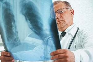 Результаты анализа рентгенологических признаков в изучении основных причин врачебных ошибок в диагностике пневмоний