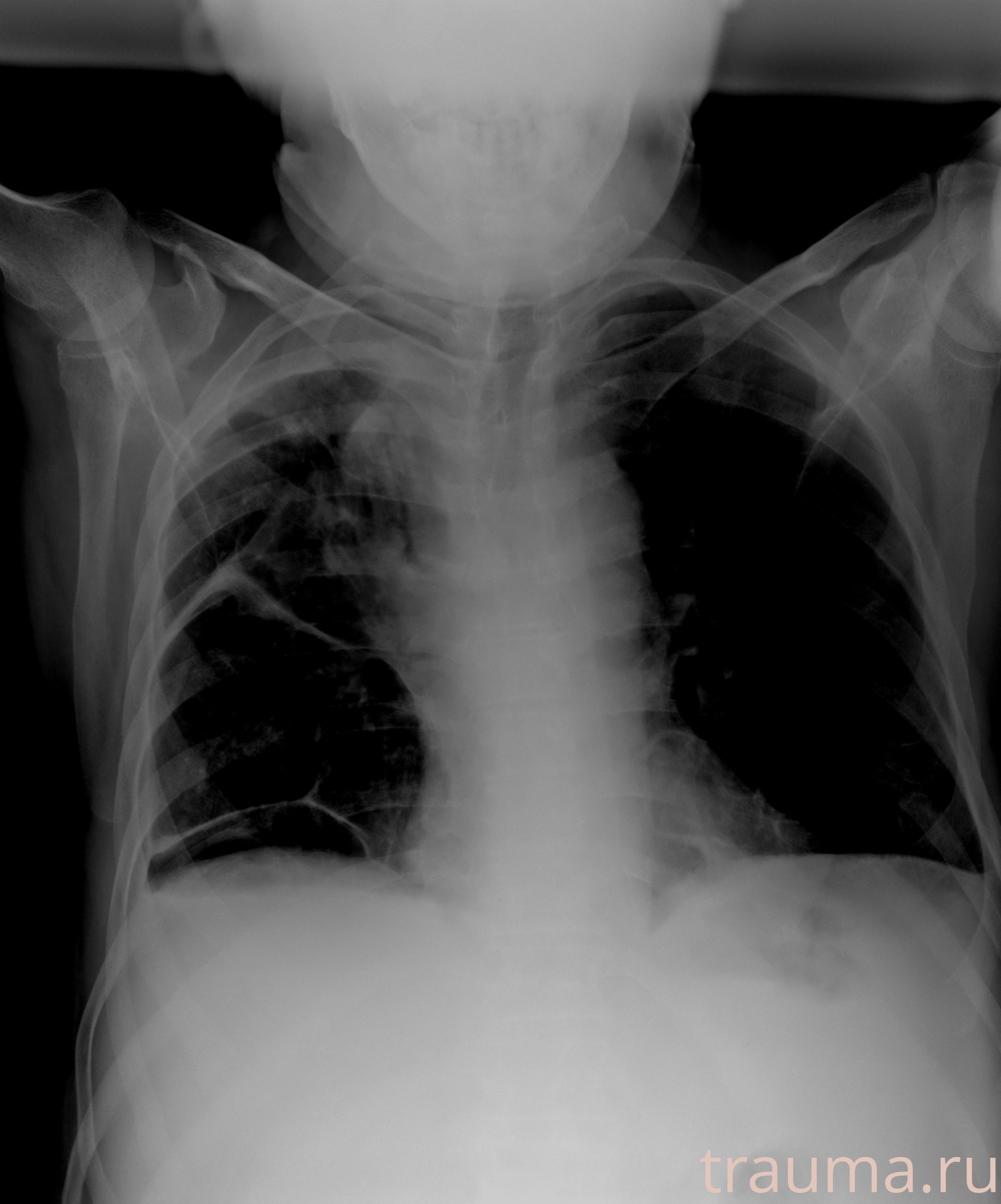 Рентген на дому: по вашему адресу приезжает врач-рентгенолог, травматолог-ортопед с мобильным рентгеновским аппаратом, проводит диагностику травмы или заболевания, делает необходимые рентгенограммы, дает рекомендации по дальнейшему лечению. Получить качественные снимки в домашних условиях возможно благодаря уникальной методике, разработанной МосРентген Центром для института  Склифосовского