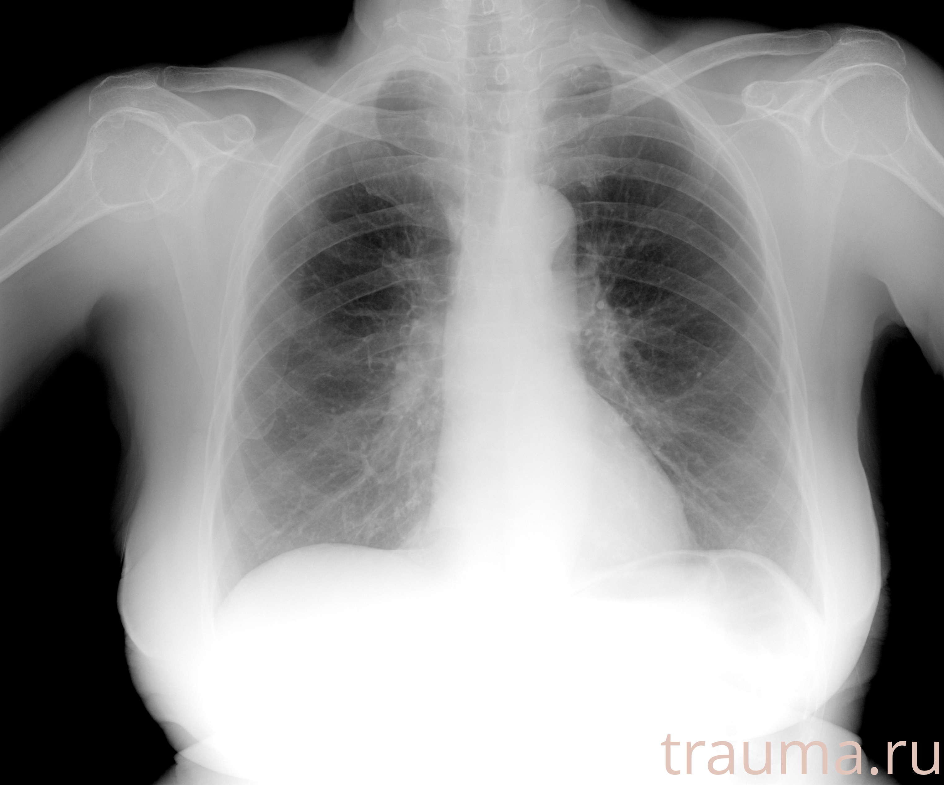 Рентген на дому: по вашему адресу приезжает врач-рентгенолог, травматолог-ортопед с мобильным рентгеновским аппаратом, проводит диагностику травмы или заболевания, делает необходимые рентгенограммы, дает рекомендации по дальнейшему лечению. Получить качественные снимки в домашних условиях возможно благодаря уникальной методике, разработанной МосРентген Центром для института  Склифосовского