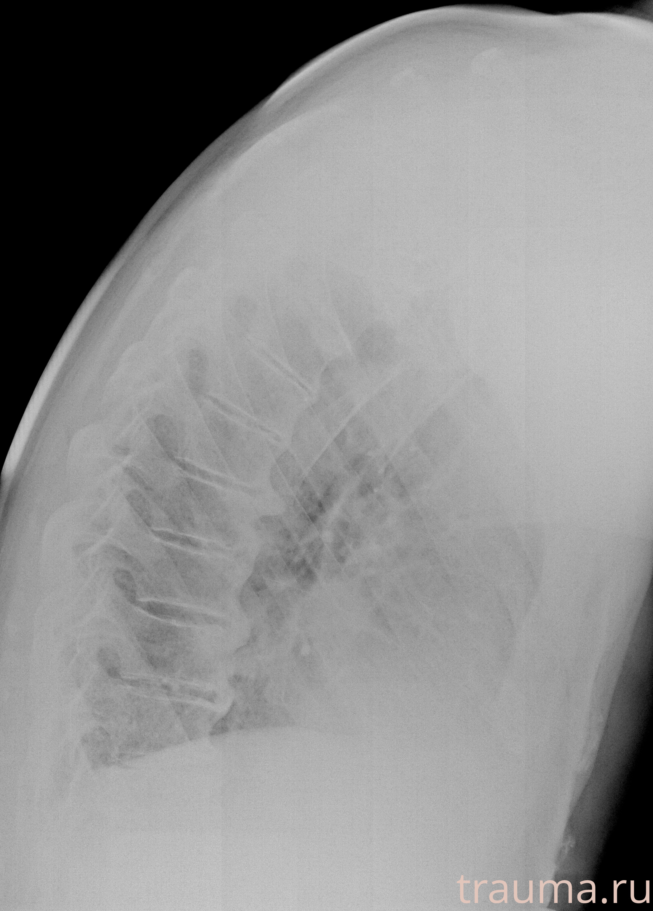 Рентген на дому: по вашему адресу приезжает врач-рентгенолог, травматолог-ортопед с мобильным рентгеновским аппаратом, проводит диагностику травмы или заболевания, делает необходимые рентгенограммы, дает рекомендации по дальнейшему лечению. Получить качественные снимки в домашних условиях возможно благодаря уникальной методике, разработанной МосРентген Центром для института  Склифосовского