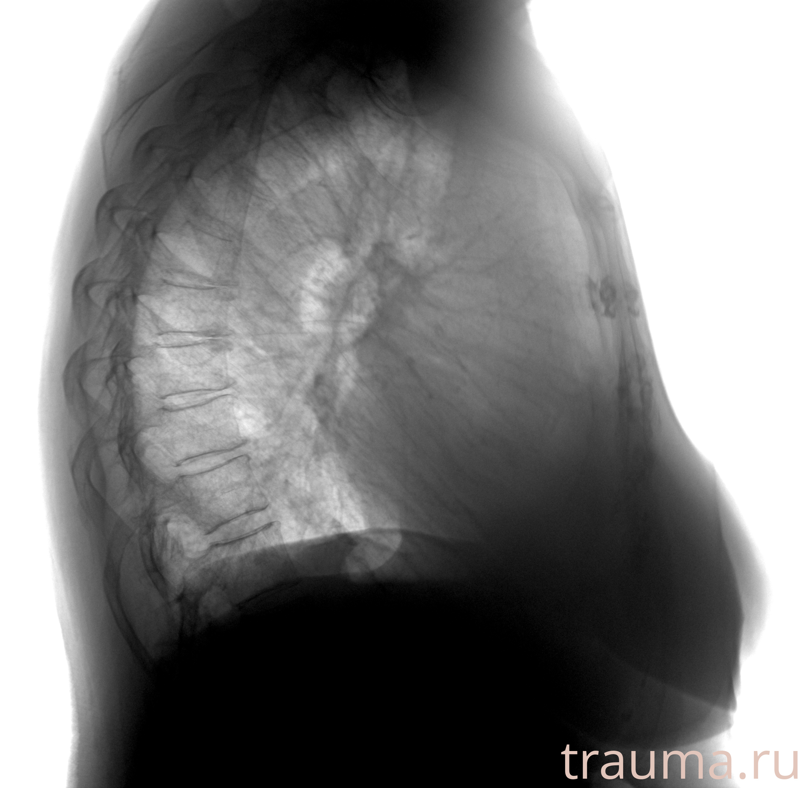 Рентген на дому: по вашему адресу приезжает врач-рентгенолог, травматолог-ортопед с мобильным рентгеновским аппаратом, проводит диагностику травмы или заболевания, делает необходимые рентгенограммы, дает рекомендации по дальнейшему лечению. Получить качественные снимки в домашних условиях возможно благодаря уникальной методике, разработанной МосРентген Центром для института  Склифосовского