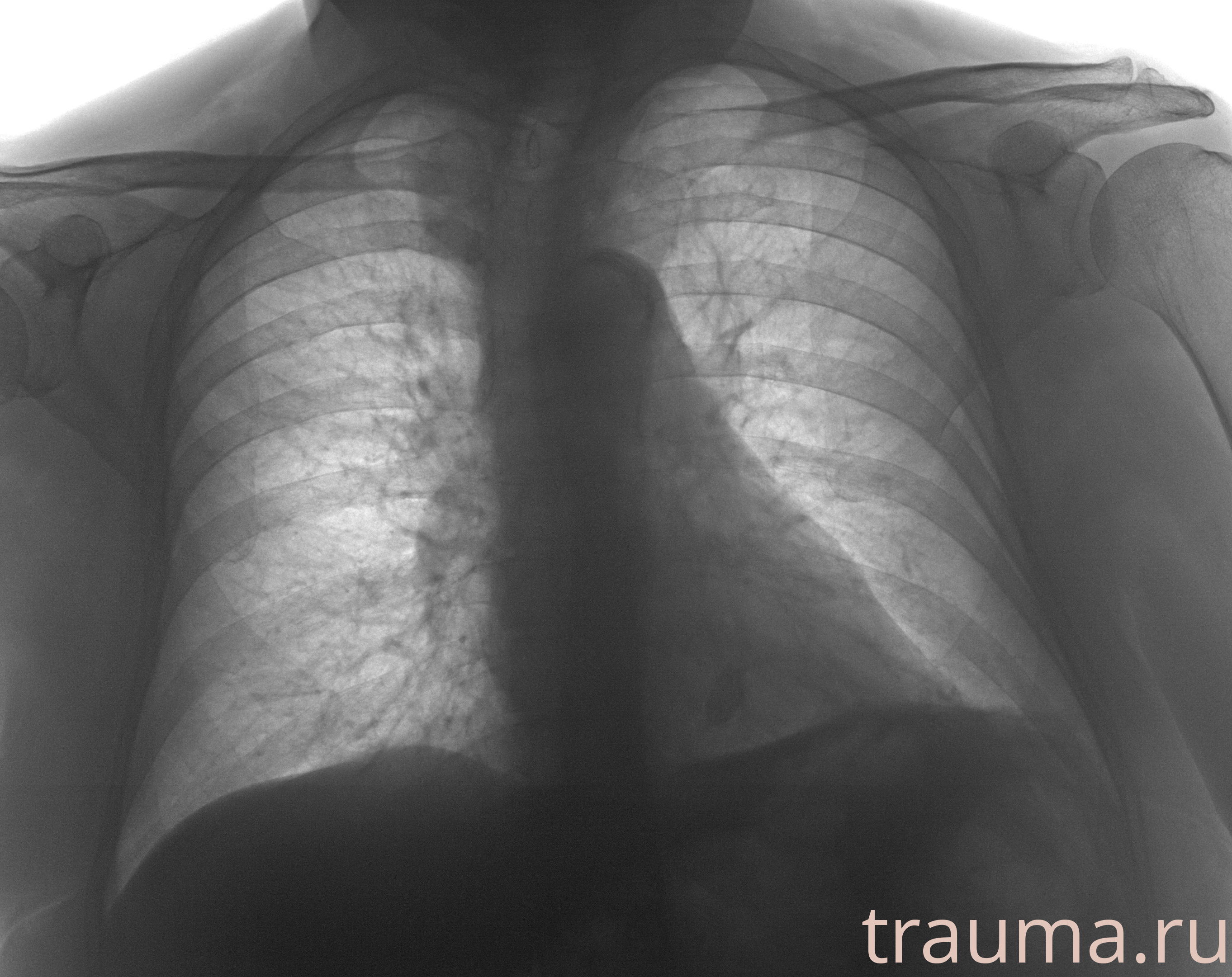 Рентген на дому: по вашему адресу приезжает врач-рентгенолог, травматолог-ортопед с мобильным рентгеновским аппаратом, проводит диагностику травмы или заболевания, делает необходимые рентгенограммы, дает рекомендации по дальнейшему лечению. Получить качественные снимки в домашних условиях возможно благодаря уникальной методике, разработанной МосРентген Центром для института  Склифосовского