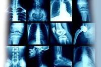   Radiography Condition Setting(  )
