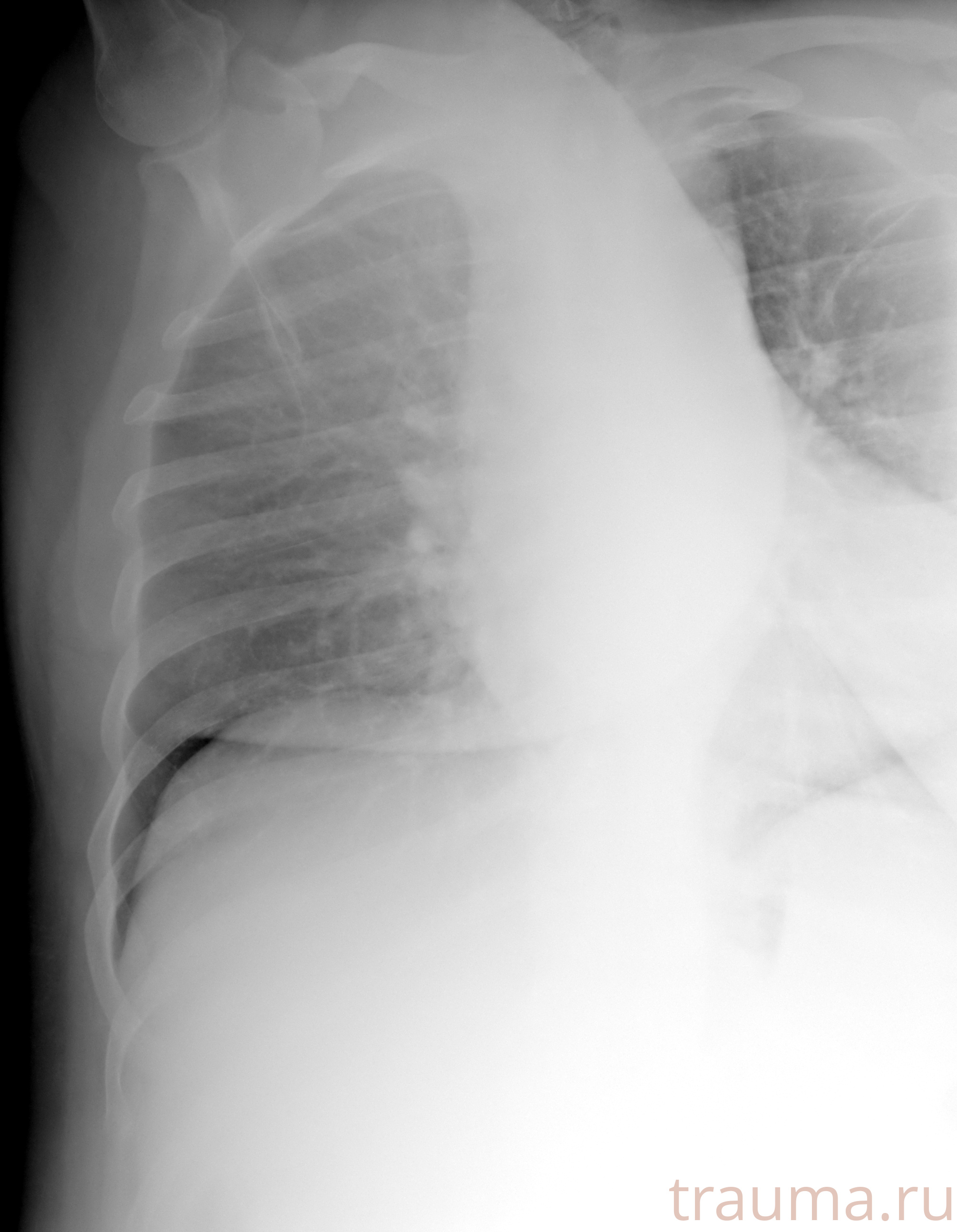 Рентген на дому: по вашему адресу приезжает врач-рентгенолог, травматолог-ортопед с мобильным рентгеновским аппаратом, проводит диагностику травмы или заболевания, делает необходимые рентгенограммы, дает рекомендации по дальнейшему лечению. Получить качественные снимки в домашних условиях возможно благодаря уникальной методике, разработанной МосРентген Центром для института  Склифосовского