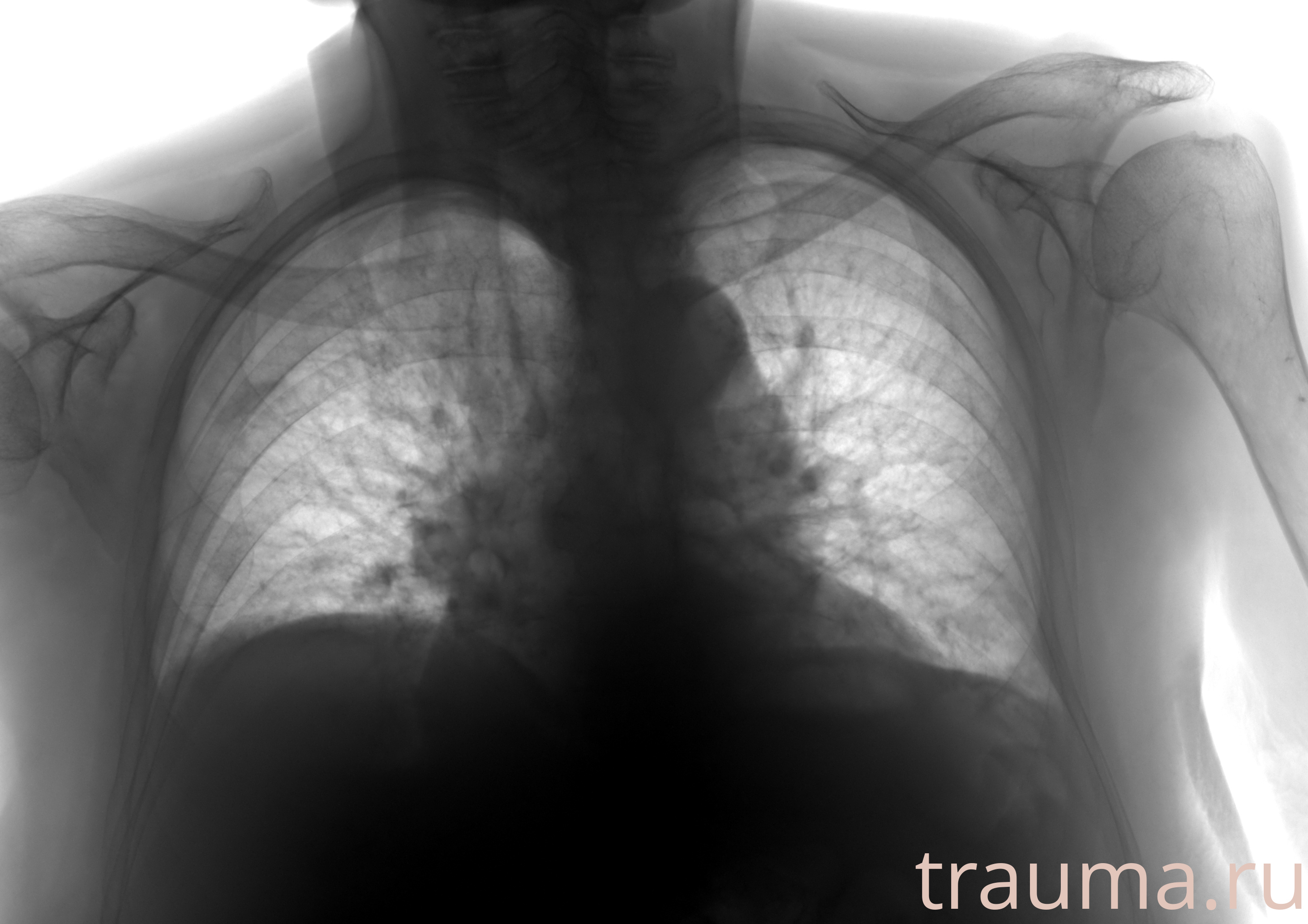 Рентген на дому: по вашему адресу приезжает врач-рентгенолог, травматолог-ортопед с мобильным рентгеновским аппаратом, проводит диагностику травмы или заболевания, делает необходимые рентгенограммы, дает рекомендации по дальнейшему лечению. Получить качественные снимки в домашних условиях возможно благодаря уникальной методике, разработанной МосРентген Центром для института  Склифосовского