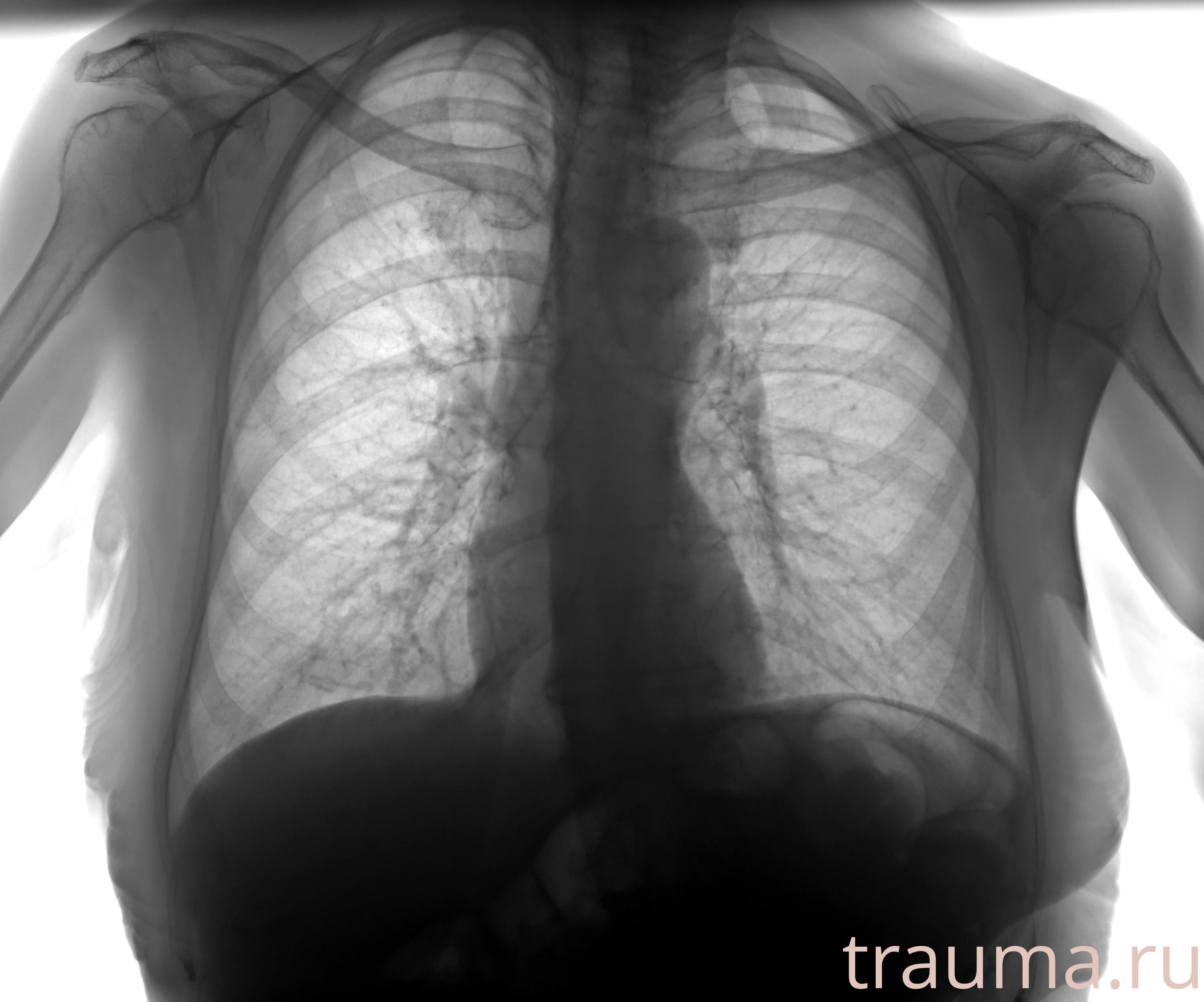 Рентген на дому: по вашему адресу приезжает врач-рентгенолог, травматолог-ортопед с мобильным рентгеновским аппаратом, проводит диагностику травмы или заболевания, делает необходимые рентгенограммы, дает рекомендации по дальнейшему лечению. Получить качественные снимки в домашних условиях возможно благодаря уникальной методике, разработанной МосРентген Центром для института  Склифосовского