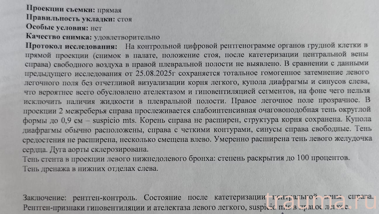 Рентген на дому: по вашему адресу приезжает врач-рентгенолог, травматолог-ортопед с мобильным рентгеновским аппаратом, проводит диагностику травмы или заболевания, делает необходимые рентгенограммы, дает рекомендации по дальнейшему лечению. Получить качественные снимки в домашних условиях возможно благодаря уникальной методике, разработанной МосРентген Центром для института  Склифосовского