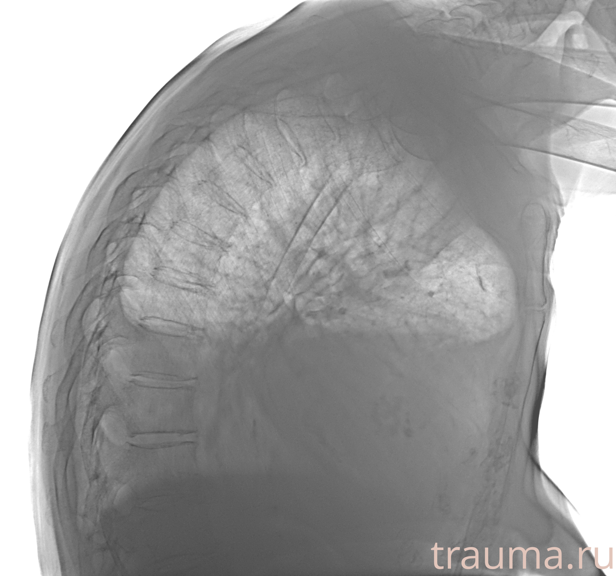 Рентген на дому: по вашему адресу приезжает врач-рентгенолог, травматолог-ортопед с мобильным рентгеновским аппаратом, проводит диагностику травмы или заболевания, делает необходимые рентгенограммы, дает рекомендации по дальнейшему лечению. Получить качественные снимки в домашних условиях возможно благодаря уникальной методике, разработанной МосРентген Центром для института  Склифосовского