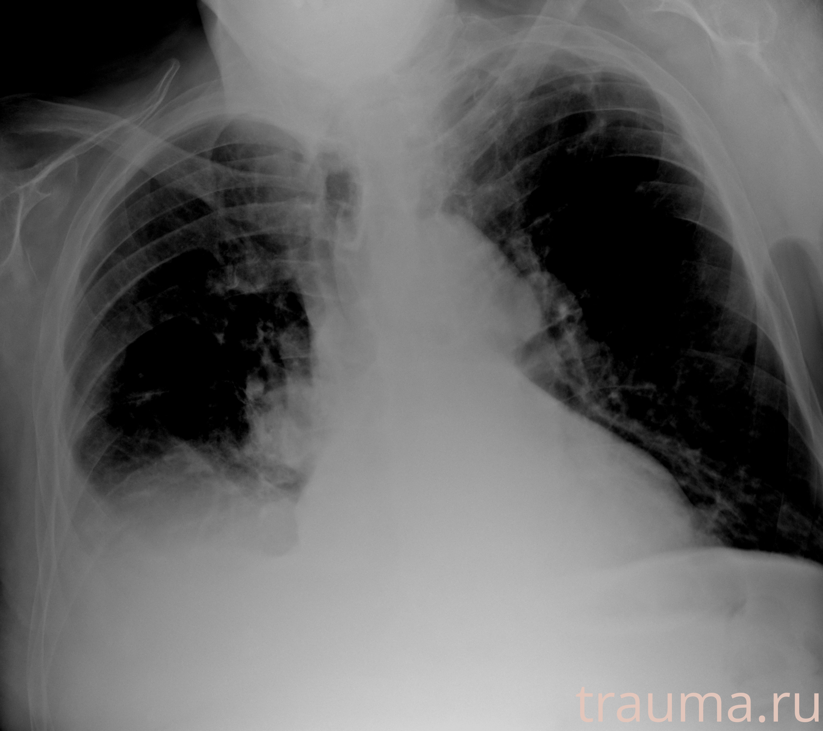 Рентген на дому: по вашему адресу приезжает врач-рентгенолог, травматолог-ортопед с мобильным рентгеновским аппаратом, проводит диагностику травмы или заболевания, делает необходимые рентгенограммы, дает рекомендации по дальнейшему лечению. Получить качественные снимки в домашних условиях возможно благодаря уникальной методике, разработанной МосРентген Центром для института  Склифосовского