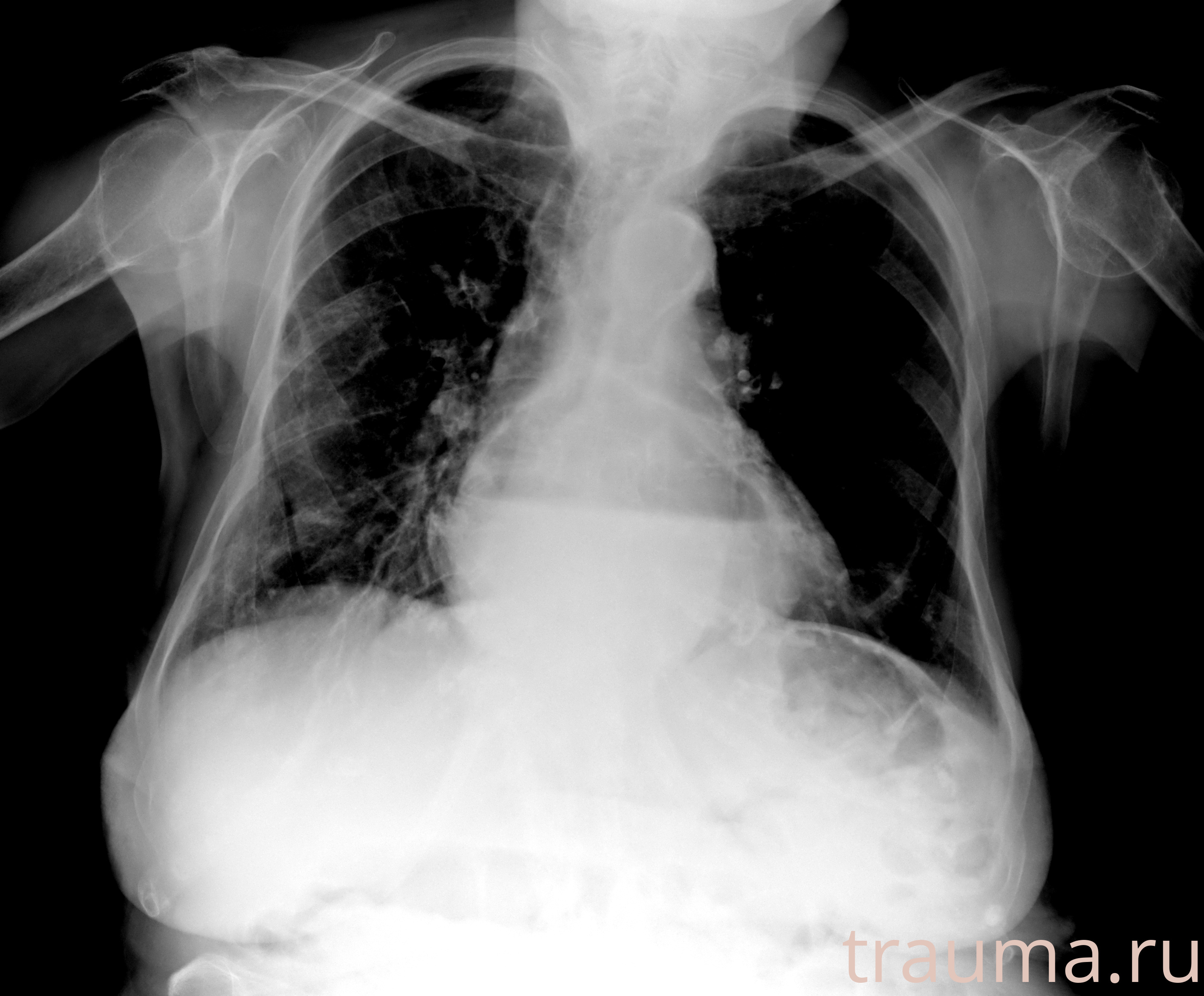 Рентген на дому: по вашему адресу приезжает врач-рентгенолог, травматолог-ортопед с мобильным рентгеновским аппаратом, проводит диагностику травмы или заболевания, делает необходимые рентгенограммы, дает рекомендации по дальнейшему лечению. Получить качественные снимки в домашних условиях возможно благодаря уникальной методике, разработанной МосРентген Центром для института  Склифосовского