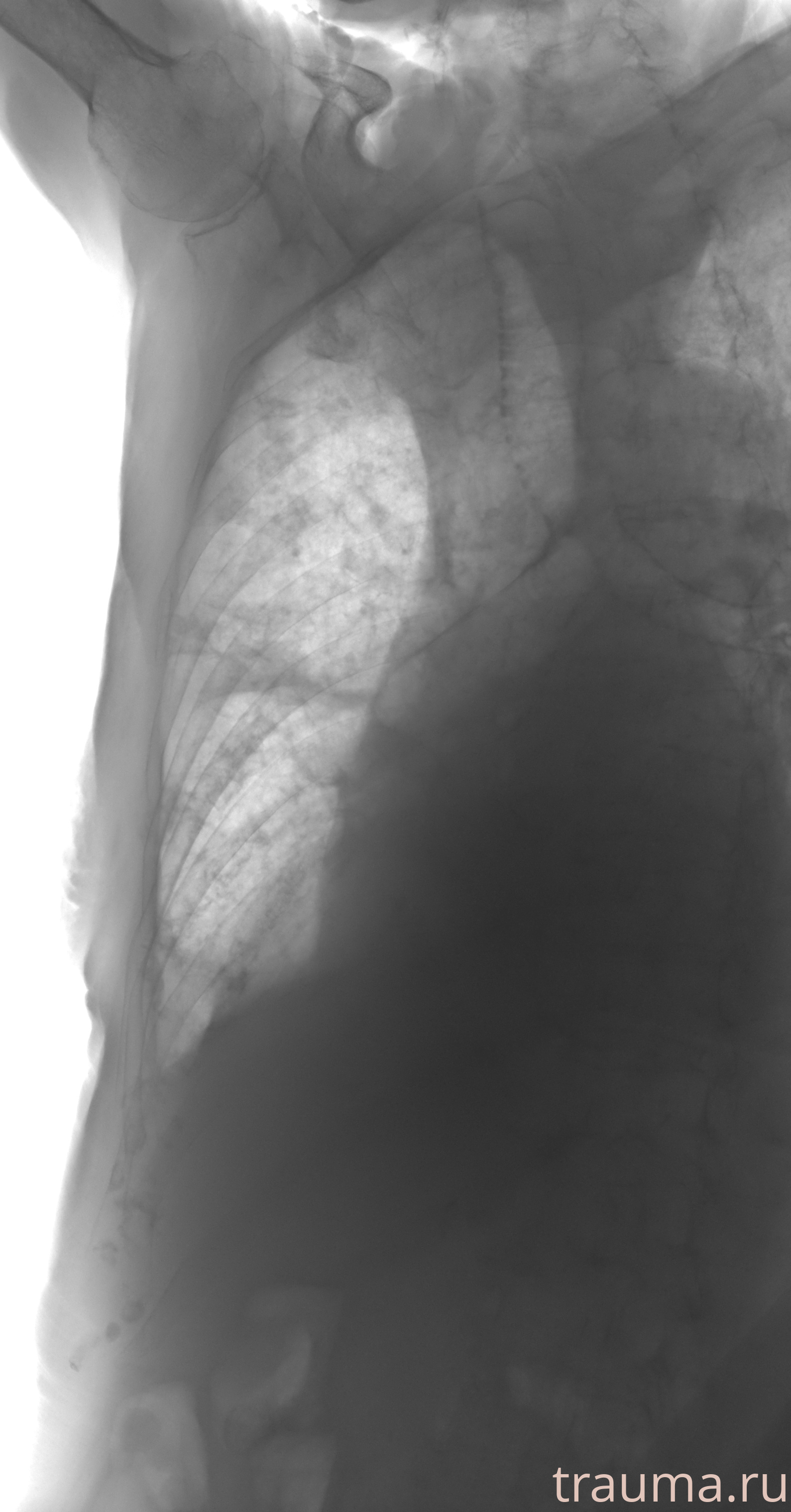 Рентген на дому: по вашему адресу приезжает врач-рентгенолог, травматолог-ортопед с мобильным рентгеновским аппаратом, проводит диагностику травмы или заболевания, делает необходимые рентгенограммы, дает рекомендации по дальнейшему лечению. Получить качественные снимки в домашних условиях возможно благодаря уникальной методике, разработанной МосРентген Центром для института  Склифосовского