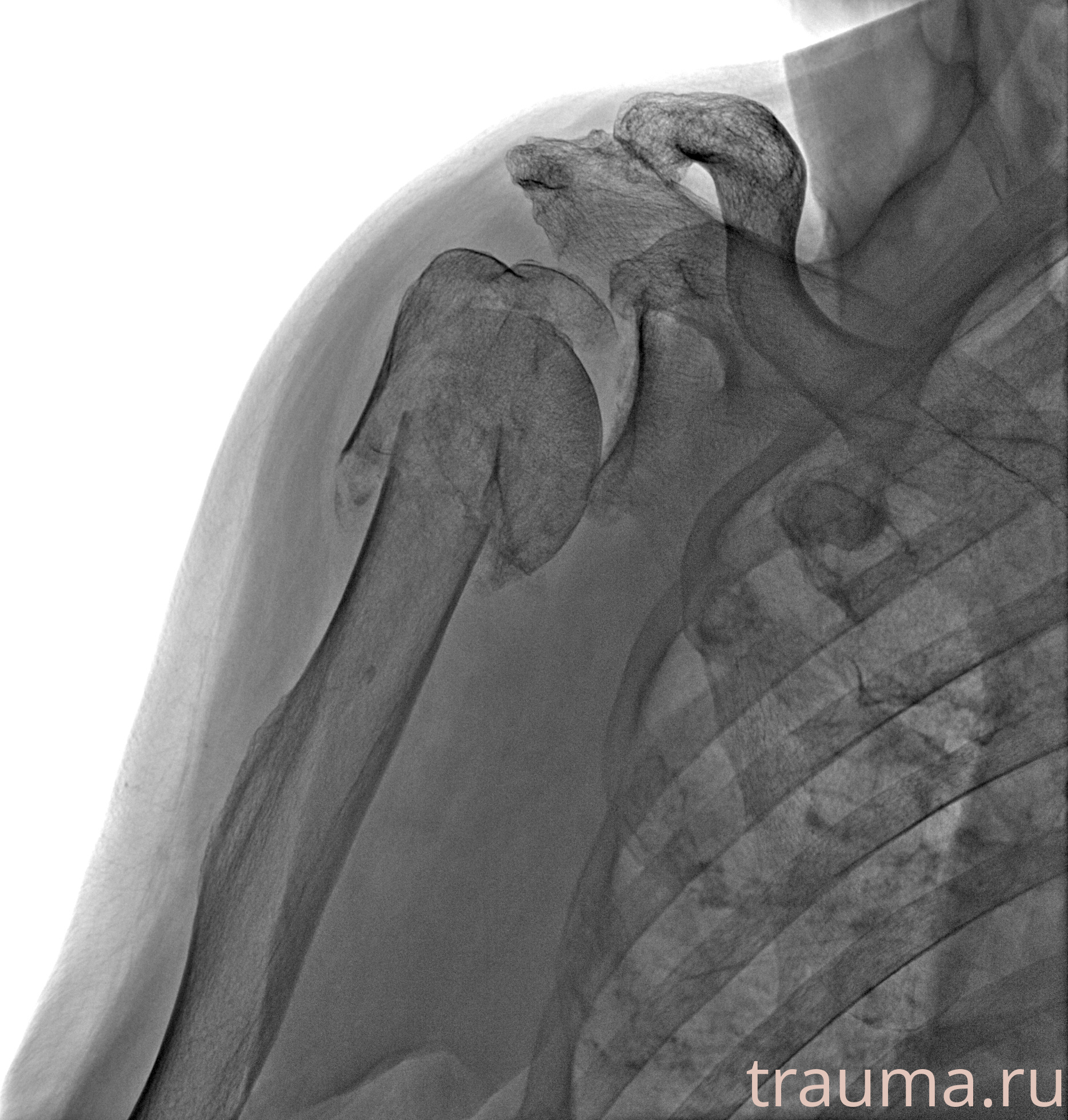 Рентген на дому: по вашему адресу приезжает врач-рентгенолог, травматолог-ортопед с мобильным рентгеновским аппаратом, проводит диагностику травмы или заболевания, делает необходимые рентгенограммы, дает рекомендации по дальнейшему лечению. Получить качественные снимки в домашних условиях возможно благодаря уникальной методике, разработанной МосРентген Центром для института  Склифосовского