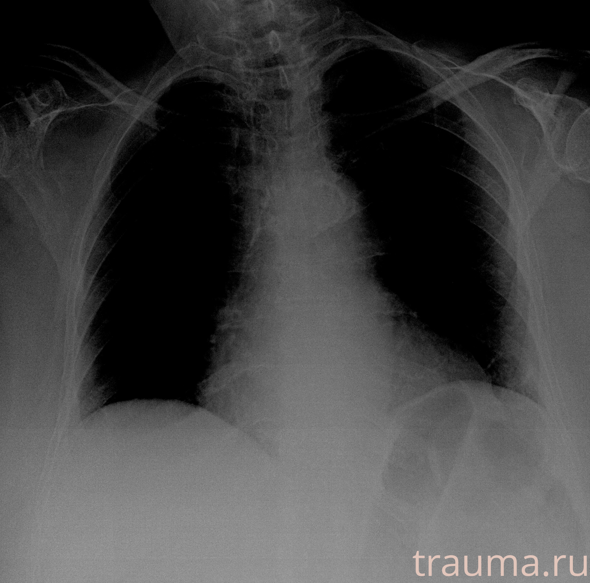 Рентген на дому: по вашему адресу приезжает врач-рентгенолог, травматолог-ортопед с мобильным рентгеновским аппаратом, проводит диагностику травмы или заболевания, делает необходимые рентгенограммы, дает рекомендации по дальнейшему лечению. Получить качественные снимки в домашних условиях возможно благодаря уникальной методике, разработанной МосРентген Центром для института  Склифосовского