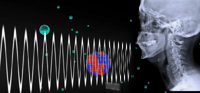 Найден новый способ управлять излучением в «мягком» рентгеновском диапазоне