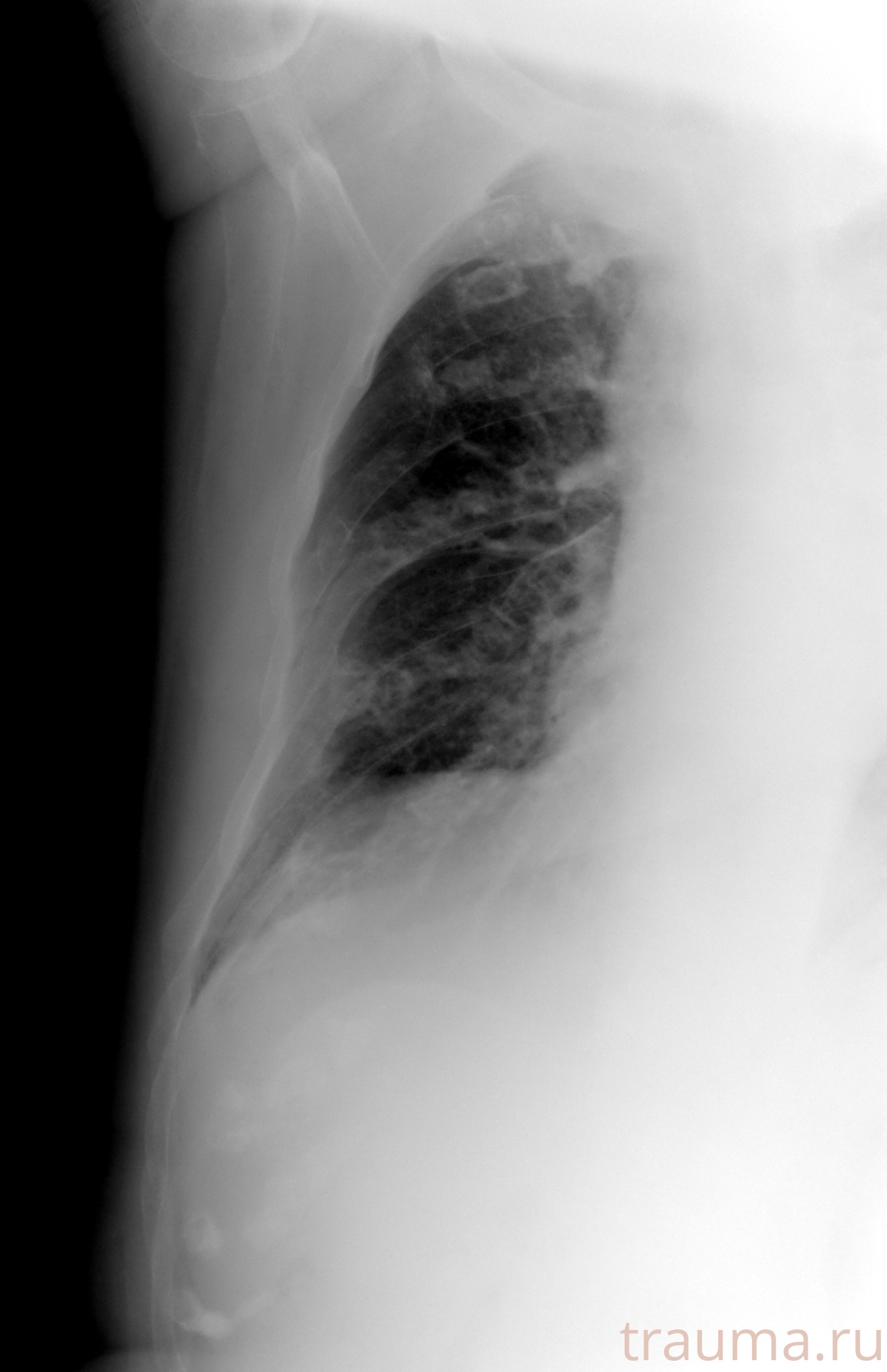 Рентген на дому: по вашему адресу приезжает врач-рентгенолог, травматолог-ортопед с мобильным рентгеновским аппаратом, проводит диагностику травмы или заболевания, делает необходимые рентгенограммы, дает рекомендации по дальнейшему лечению. Получить качественные снимки в домашних условиях возможно благодаря уникальной методике, разработанной МосРентген Центром для института  Склифосовского