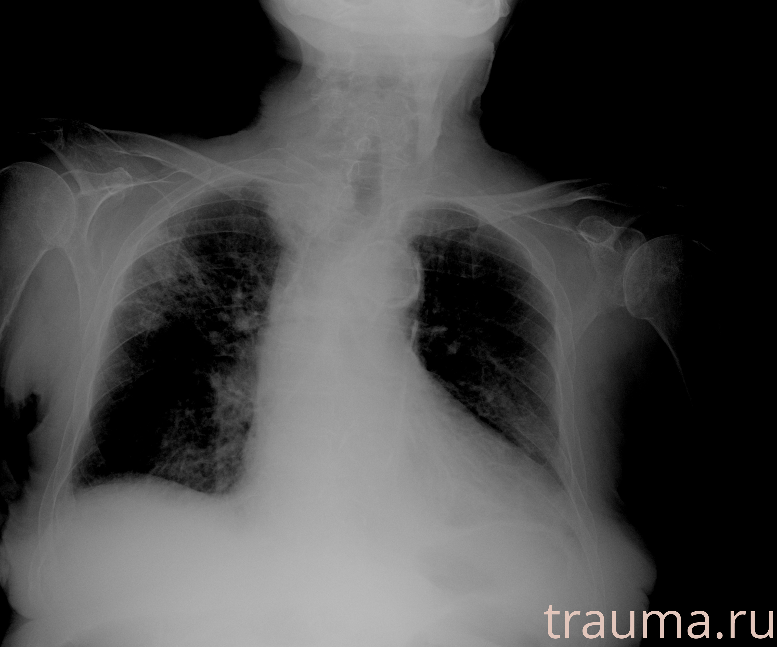 Рентген на дому: по вашему адресу приезжает врач-рентгенолог, травматолог-ортопед с мобильным рентгеновским аппаратом, проводит диагностику травмы или заболевания, делает необходимые рентгенограммы, дает рекомендации по дальнейшему лечению. Получить качественные снимки в домашних условиях возможно благодаря уникальной методике, разработанной МосРентген Центром для института  Склифосовского