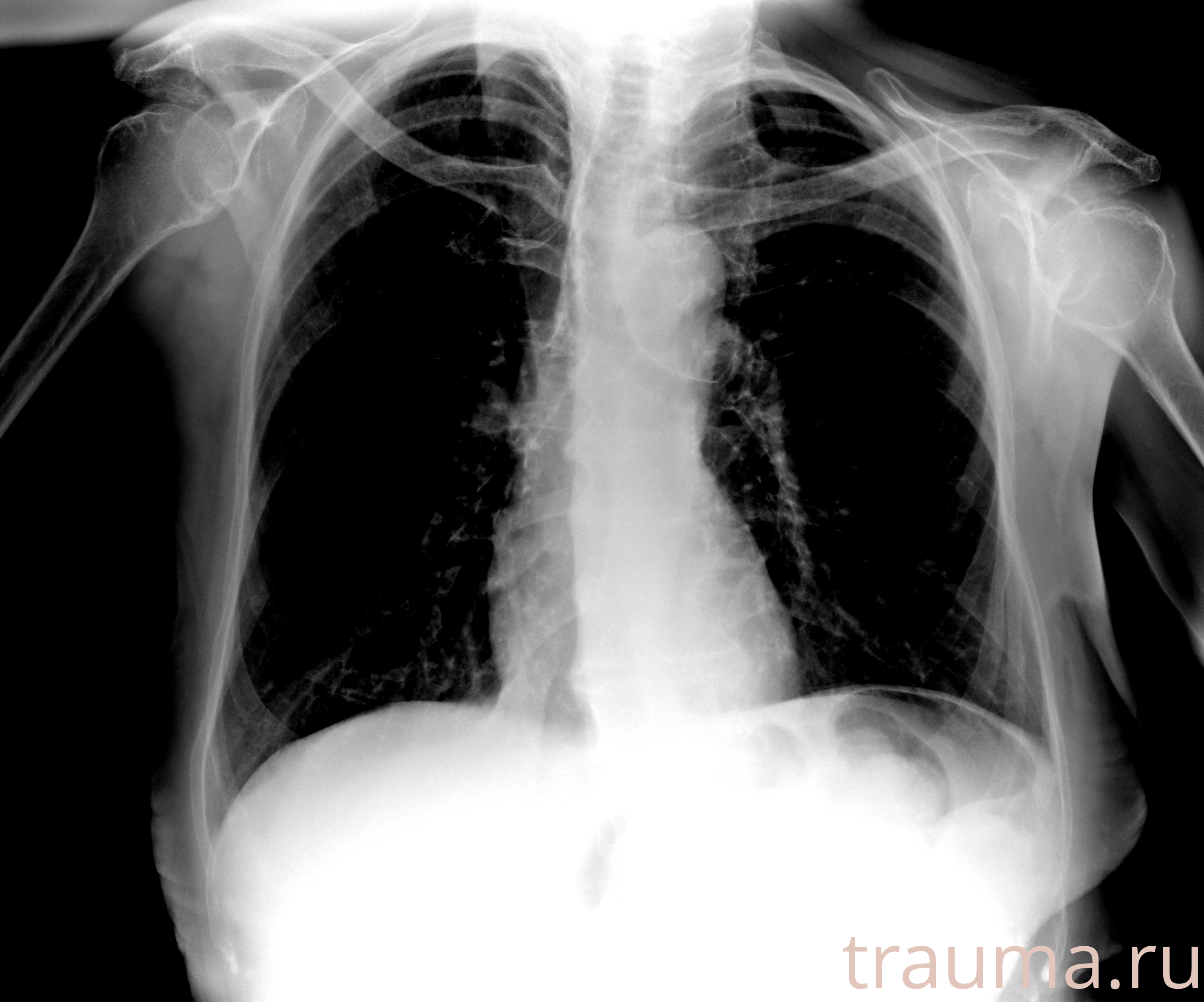 Рентген на дому: по вашему адресу приезжает врач-рентгенолог, травматолог-ортопед с мобильным рентгеновским аппаратом, проводит диагностику травмы или заболевания, делает необходимые рентгенограммы, дает рекомендации по дальнейшему лечению. Получить качественные снимки в домашних условиях возможно благодаря уникальной методике, разработанной МосРентген Центром для института  Склифосовского