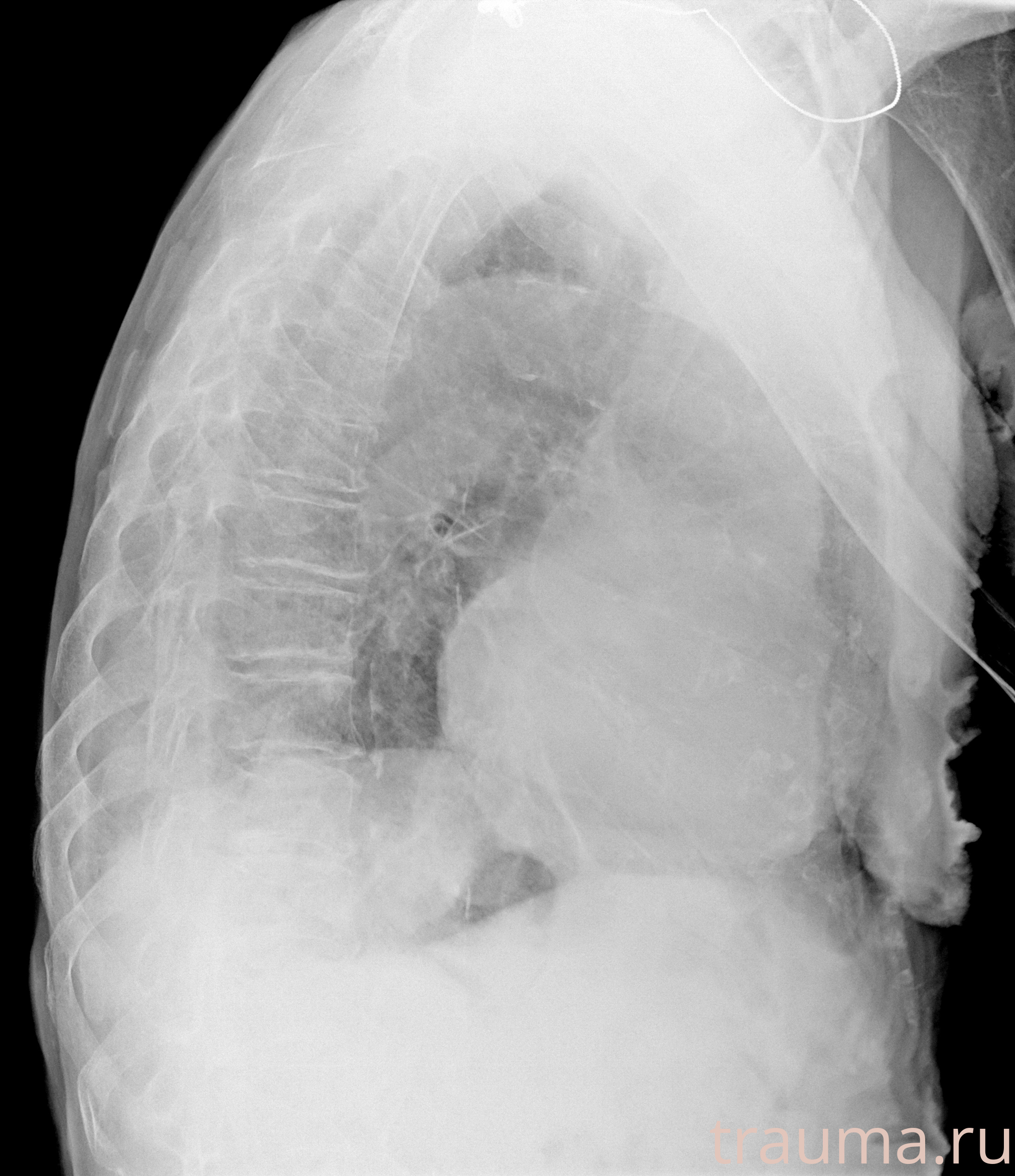 Рентген на дому: по вашему адресу приезжает врач-рентгенолог, травматолог-ортопед с мобильным рентгеновским аппаратом, проводит диагностику травмы или заболевания, делает необходимые рентгенограммы, дает рекомендации по дальнейшему лечению. Получить качественные снимки в домашних условиях возможно благодаря уникальной методике, разработанной МосРентген Центром для института  Склифосовского