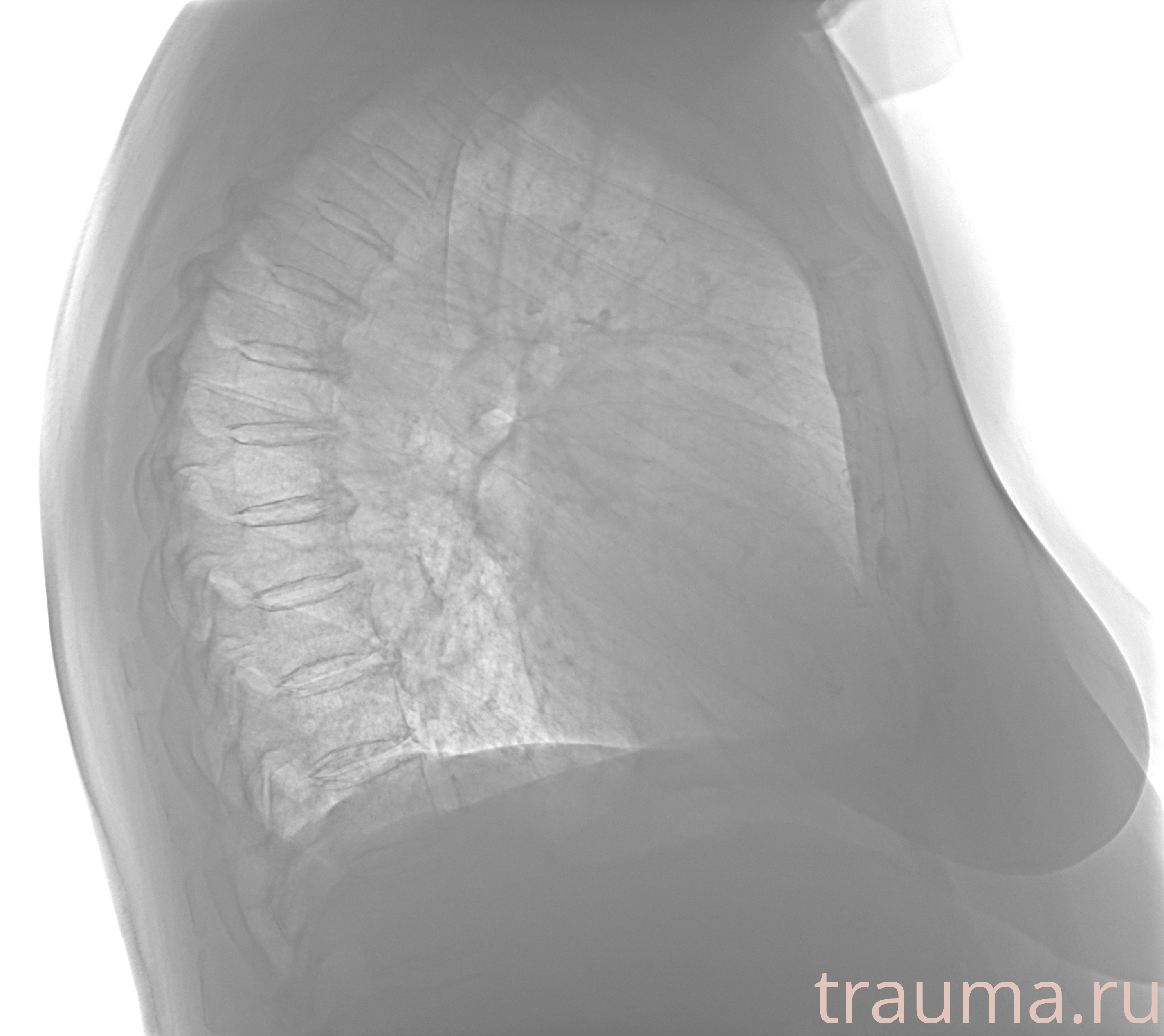 Рентген на дому: по вашему адресу приезжает врач-рентгенолог, травматолог-ортопед с мобильным рентгеновским аппаратом, проводит диагностику травмы или заболевания, делает необходимые рентгенограммы, дает рекомендации по дальнейшему лечению. Получить качественные снимки в домашних условиях возможно благодаря уникальной методике, разработанной МосРентген Центром для института  Склифосовского