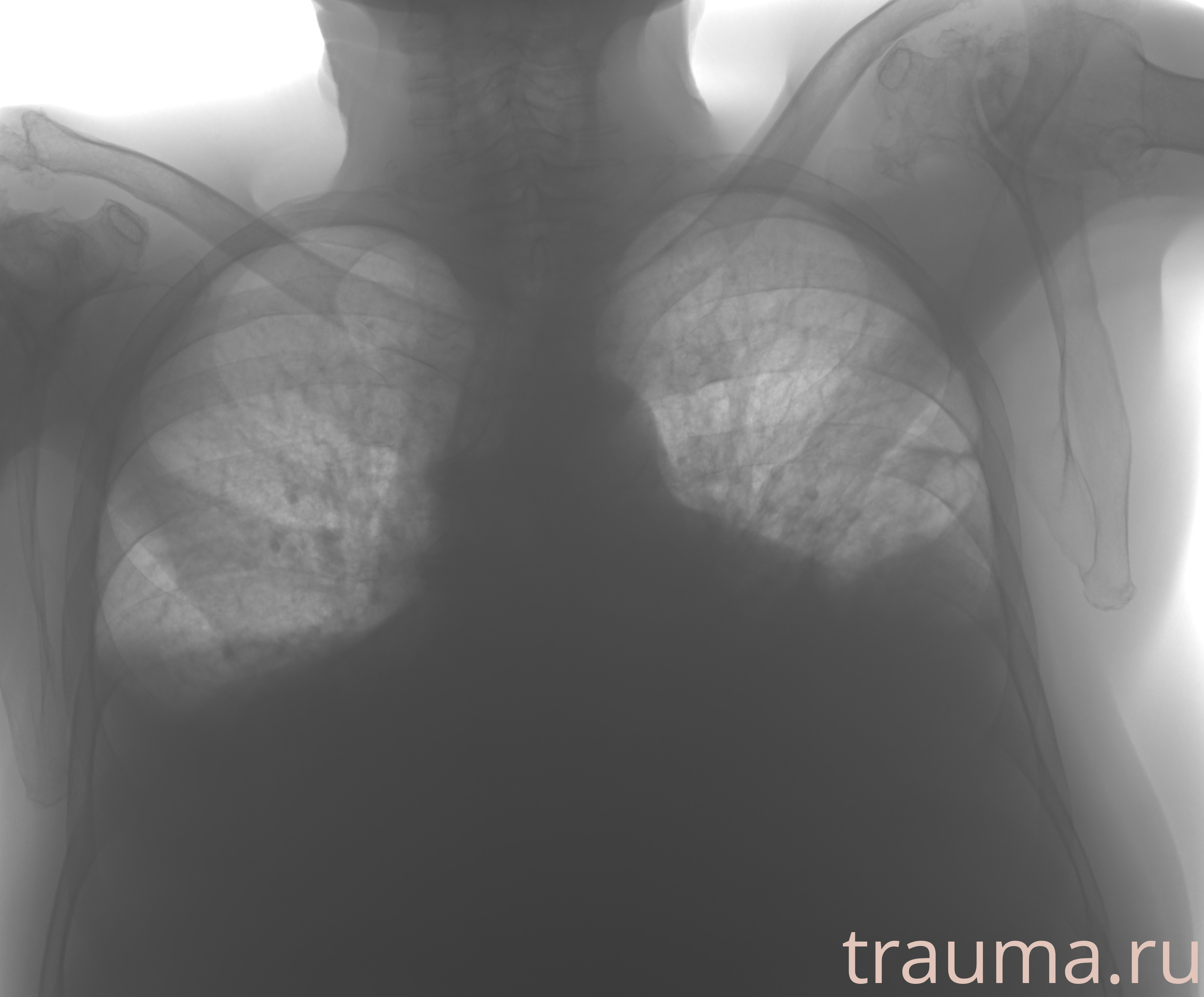 Рентген на дому: по вашему адресу приезжает врач-рентгенолог, травматолог-ортопед с мобильным рентгеновским аппаратом, проводит диагностику травмы или заболевания, делает необходимые рентгенограммы, дает рекомендации по дальнейшему лечению. Получить качественные снимки в домашних условиях возможно благодаря уникальной методике, разработанной МосРентген Центром для института  Склифосовского