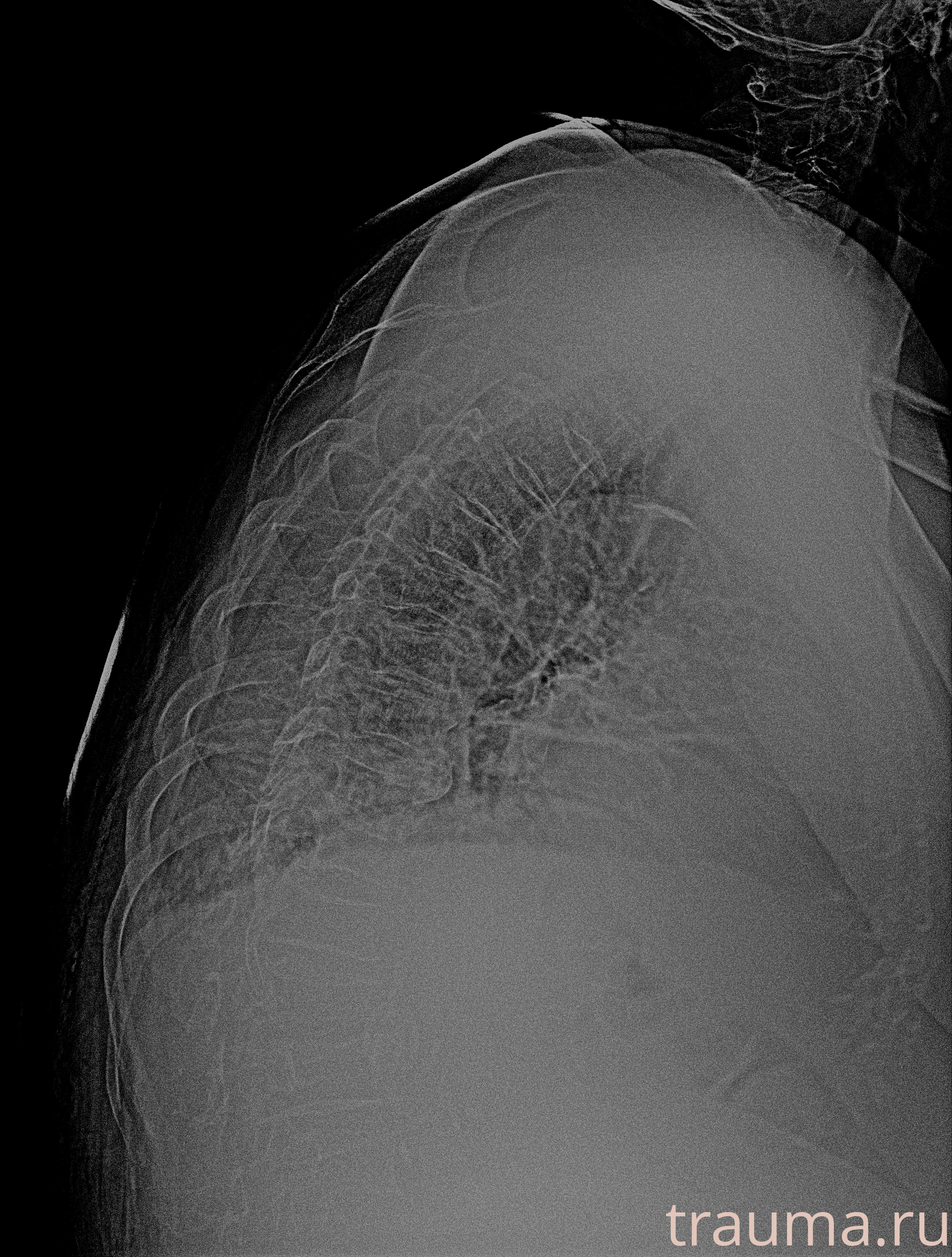 Рентген на дому: по вашему адресу приезжает врач-рентгенолог, травматолог-ортопед с мобильным рентгеновским аппаратом, проводит диагностику травмы или заболевания, делает необходимые рентгенограммы, дает рекомендации по дальнейшему лечению. Получить качественные снимки в домашних условиях возможно благодаря уникальной методике, разработанной МосРентген Центром для института  Склифосовского