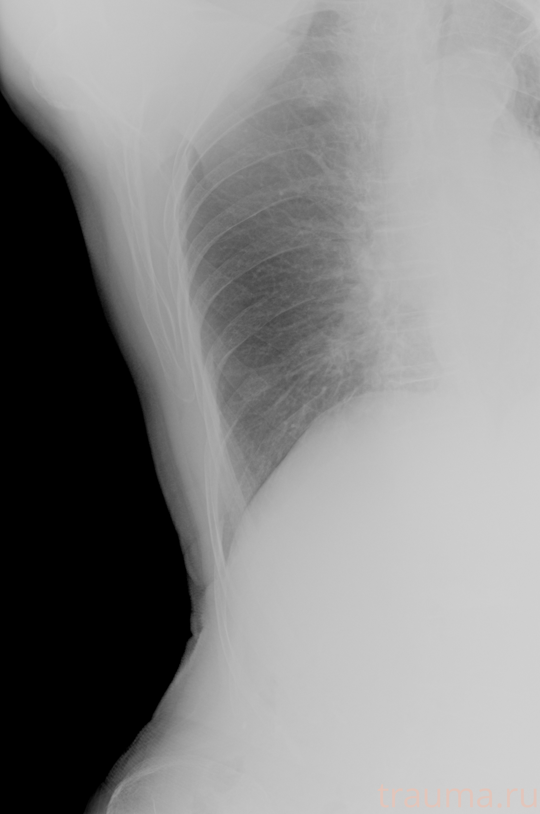 Рентген на дому: по вашему адресу приезжает врач-рентгенолог, травматолог-ортопед с мобильным рентгеновским аппаратом, проводит диагностику травмы или заболевания, делает необходимые рентгенограммы, дает рекомендации по дальнейшему лечению. Получить качественные снимки в домашних условиях возможно благодаря уникальной методике, разработанной МосРентген Центром для института  Склифосовского