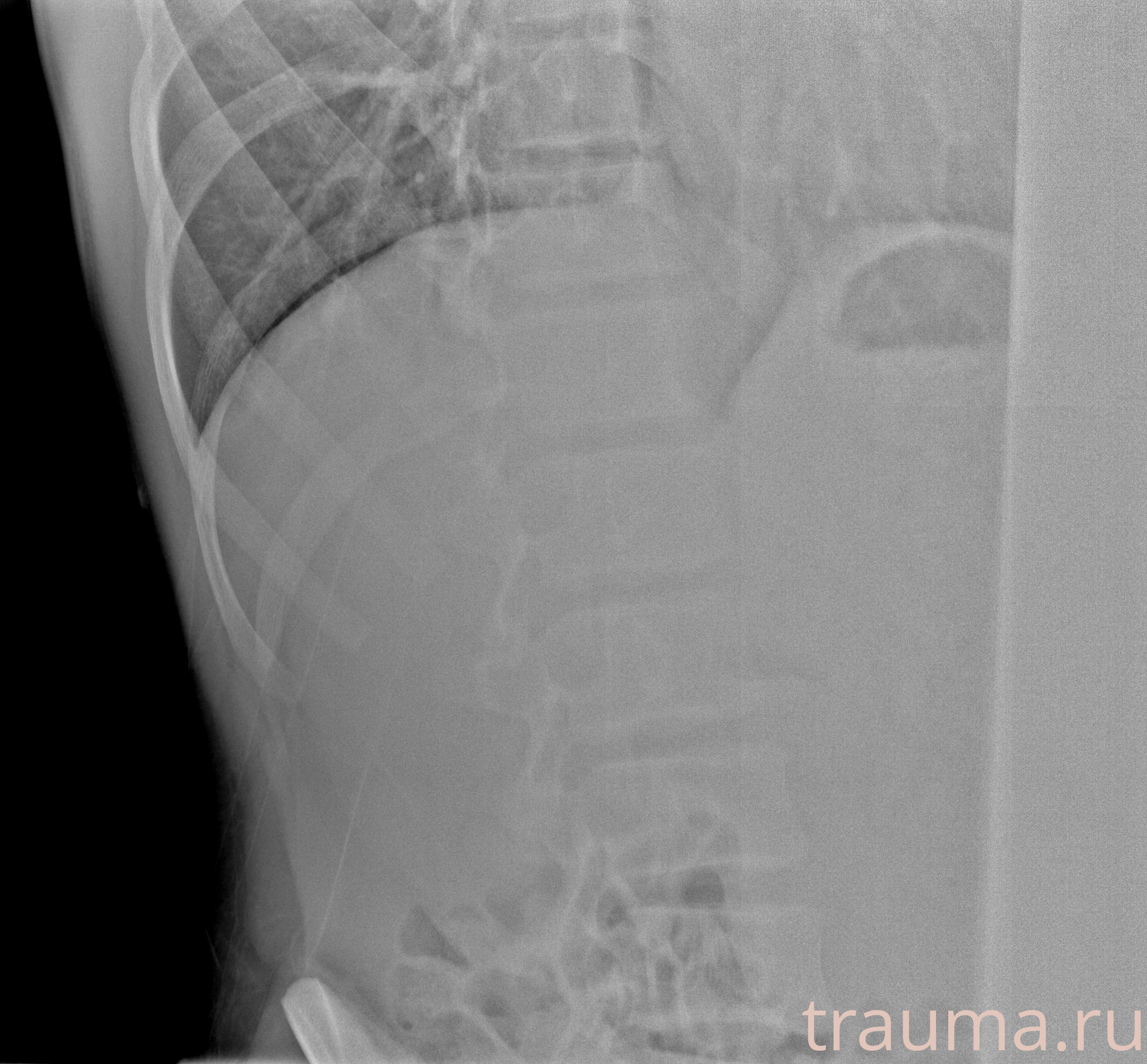 Рентген на дому: по вашему адресу приезжает врач-рентгенолог, травматолог-ортопед с мобильным рентгеновским аппаратом, проводит диагностику травмы или заболевания, делает необходимые рентгенограммы, дает рекомендации по дальнейшему лечению. Получить качественные снимки в домашних условиях возможно благодаря уникальной методике, разработанной МосРентген Центром для института  Склифосовского