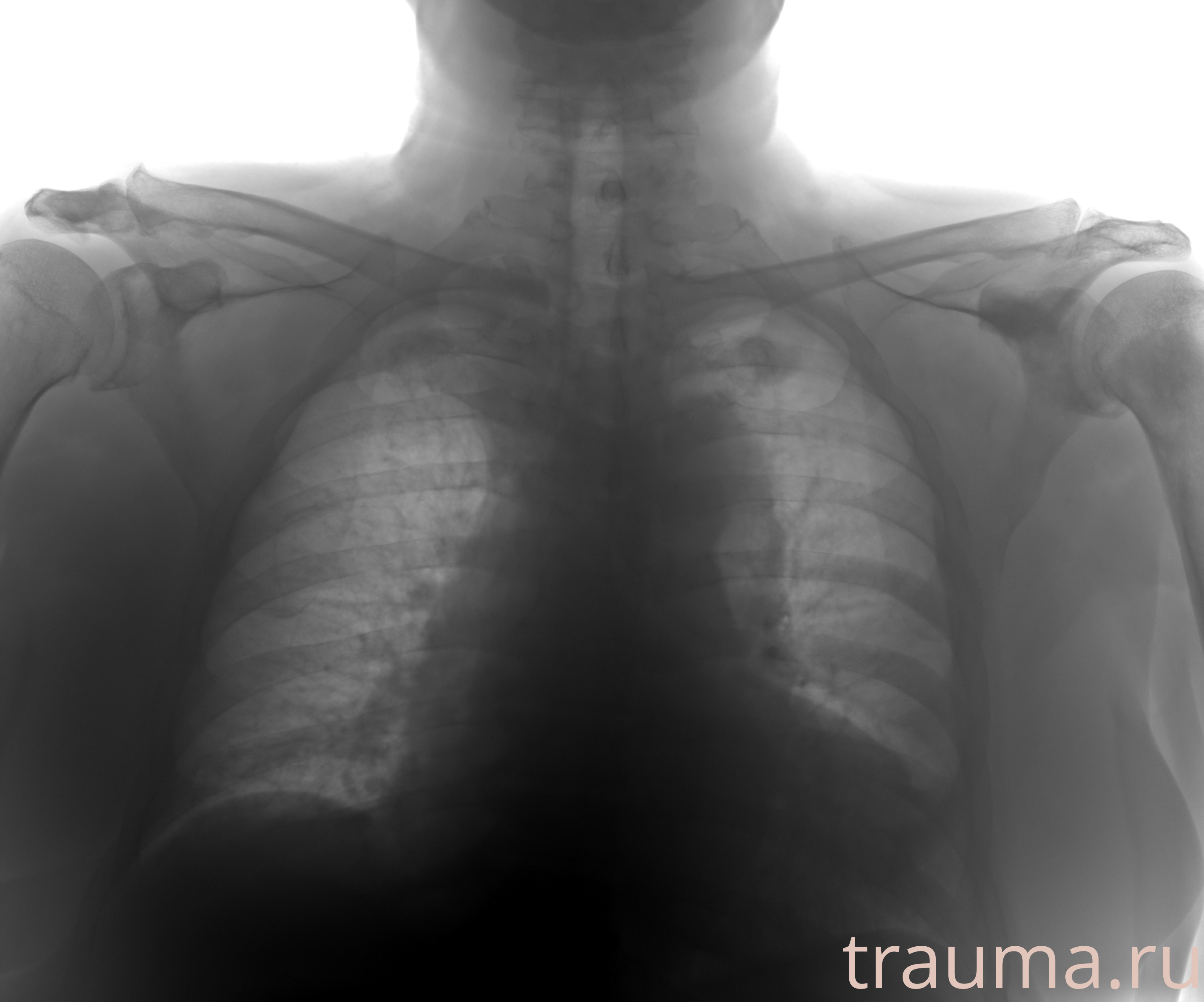 Рентген на дому: по вашему адресу приезжает врач-рентгенолог, травматолог-ортопед с мобильным рентгеновским аппаратом, проводит диагностику травмы или заболевания, делает необходимые рентгенограммы, дает рекомендации по дальнейшему лечению. Получить качественные снимки в домашних условиях возможно благодаря уникальной методике, разработанной МосРентген Центром для института  Склифосовского