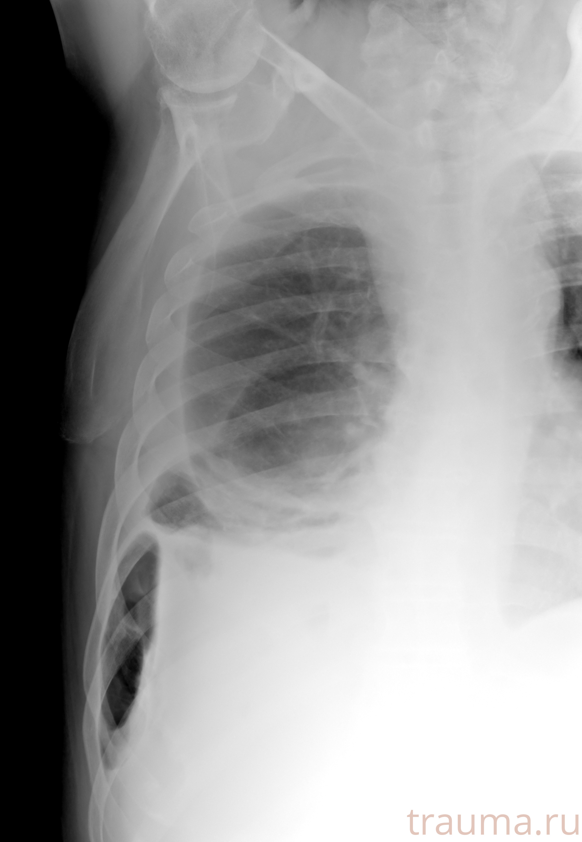 Рентген на дому: по вашему адресу приезжает врач-рентгенолог, травматолог-ортопед с мобильным рентгеновским аппаратом, проводит диагностику травмы или заболевания, делает необходимые рентгенограммы, дает рекомендации по дальнейшему лечению. Получить качественные снимки в домашних условиях возможно благодаря уникальной методике, разработанной МосРентген Центром для института  Склифосовского