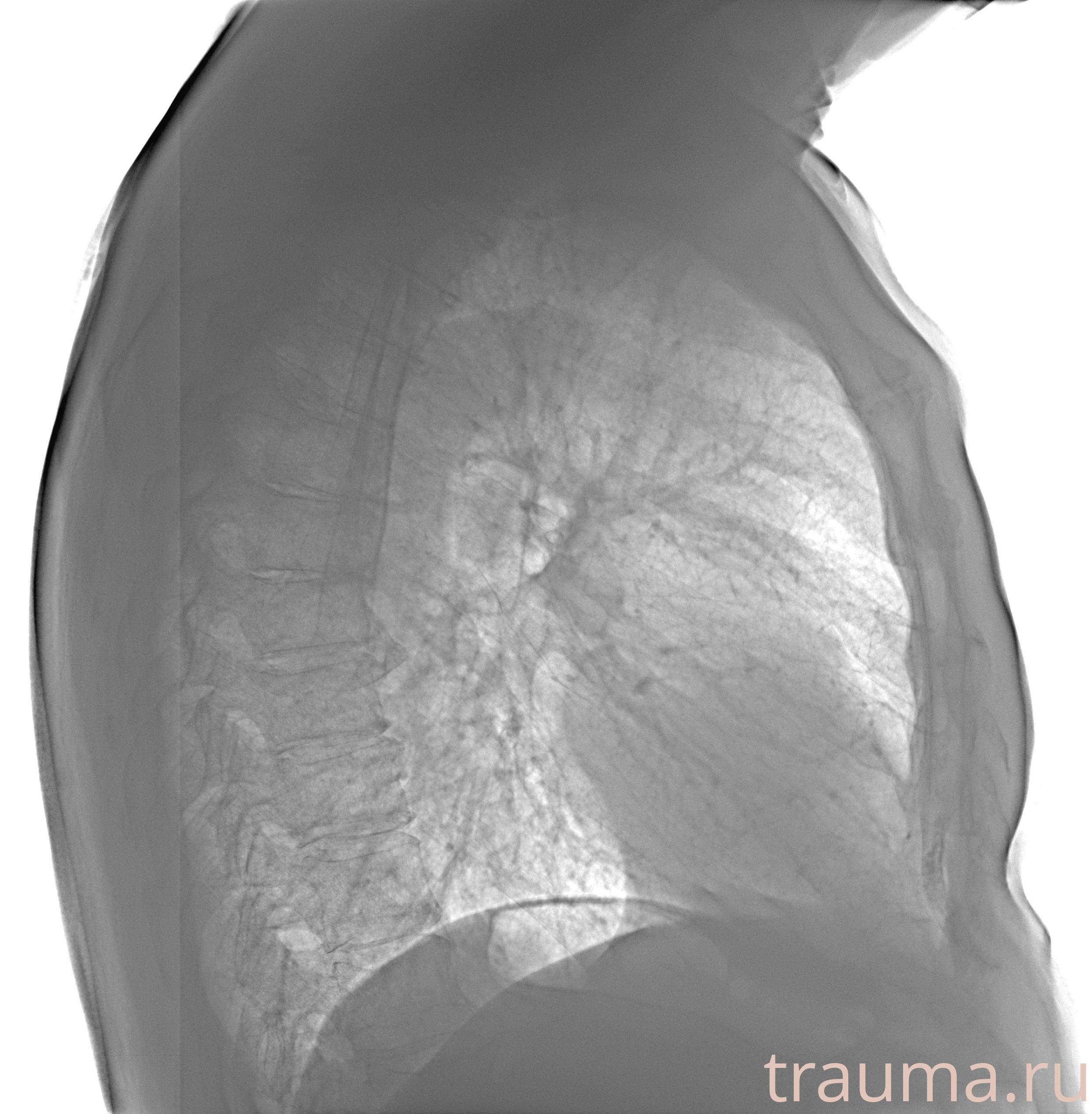 Рентген на дому: по вашему адресу приезжает врач-рентгенолог, травматолог-ортопед с мобильным рентгеновским аппаратом, проводит диагностику травмы или заболевания, делает необходимые рентгенограммы, дает рекомендации по дальнейшему лечению. Получить качественные снимки в домашних условиях возможно благодаря уникальной методике, разработанной МосРентген Центром для института  Склифосовского