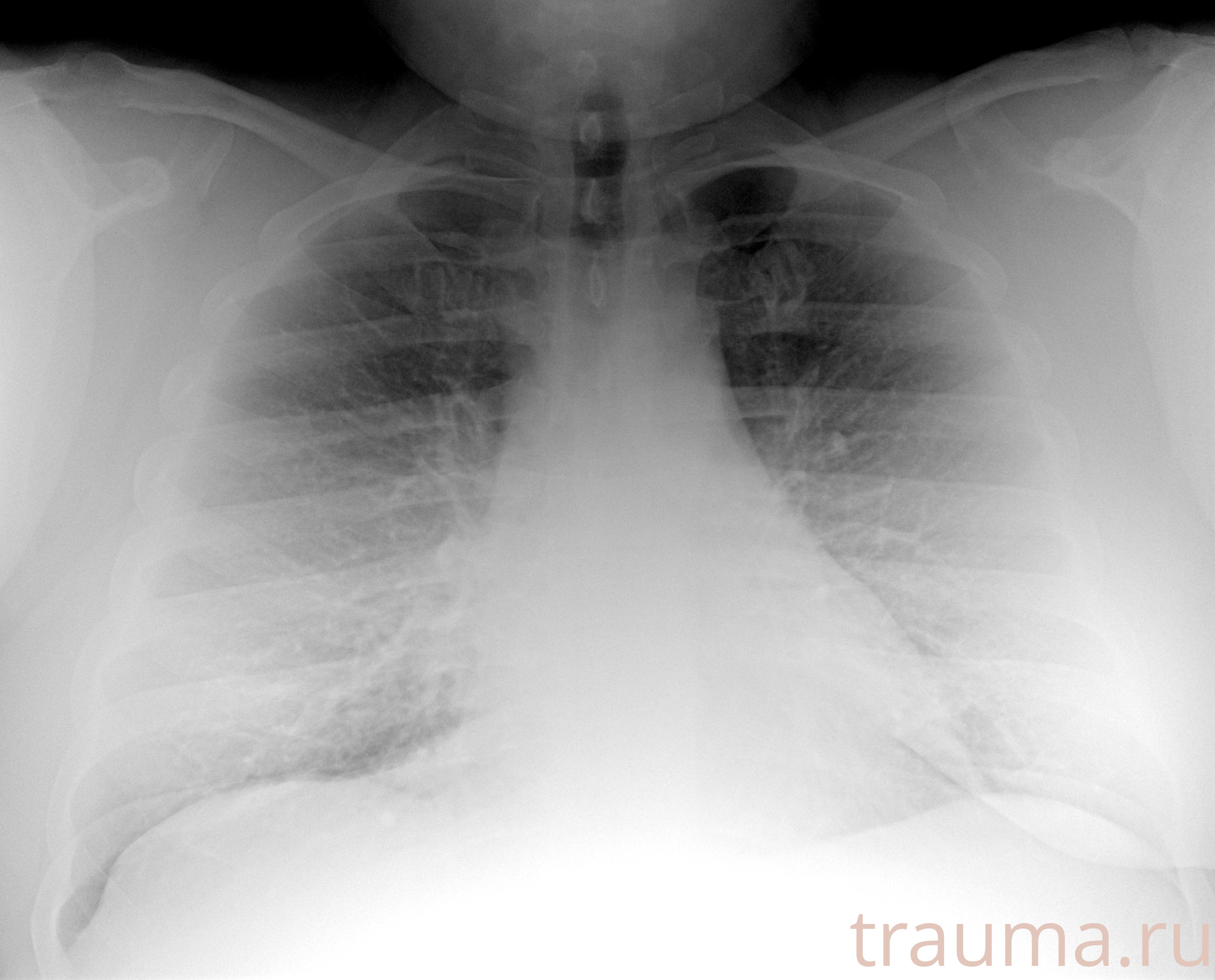 Рентген на дому: по вашему адресу приезжает врач-рентгенолог, травматолог-ортопед с мобильным рентгеновским аппаратом, проводит диагностику травмы или заболевания, делает необходимые рентгенограммы, дает рекомендации по дальнейшему лечению. Получить качественные снимки в домашних условиях возможно благодаря уникальной методике, разработанной МосРентген Центром для института  Склифосовского