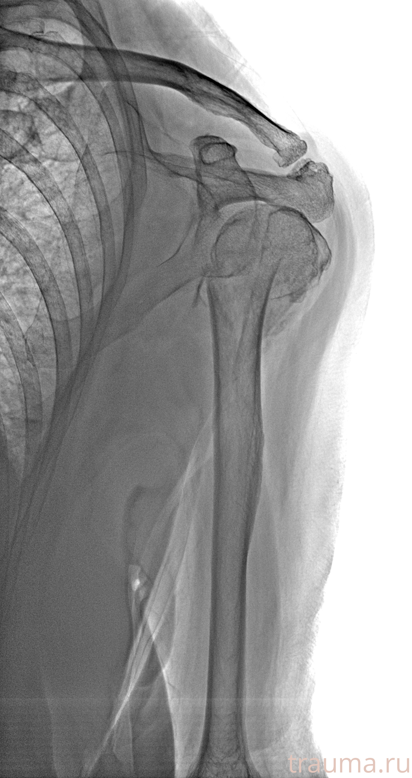 Рентген на дому: по вашему адресу приезжает врач-рентгенолог, травматолог-ортопед с мобильным рентгеновским аппаратом, проводит диагностику травмы или заболевания, делает необходимые рентгенограммы, дает рекомендации по дальнейшему лечению. Получить качественные снимки в домашних условиях возможно благодаря уникальной методике, разработанной МосРентген Центром для института  Склифосовского