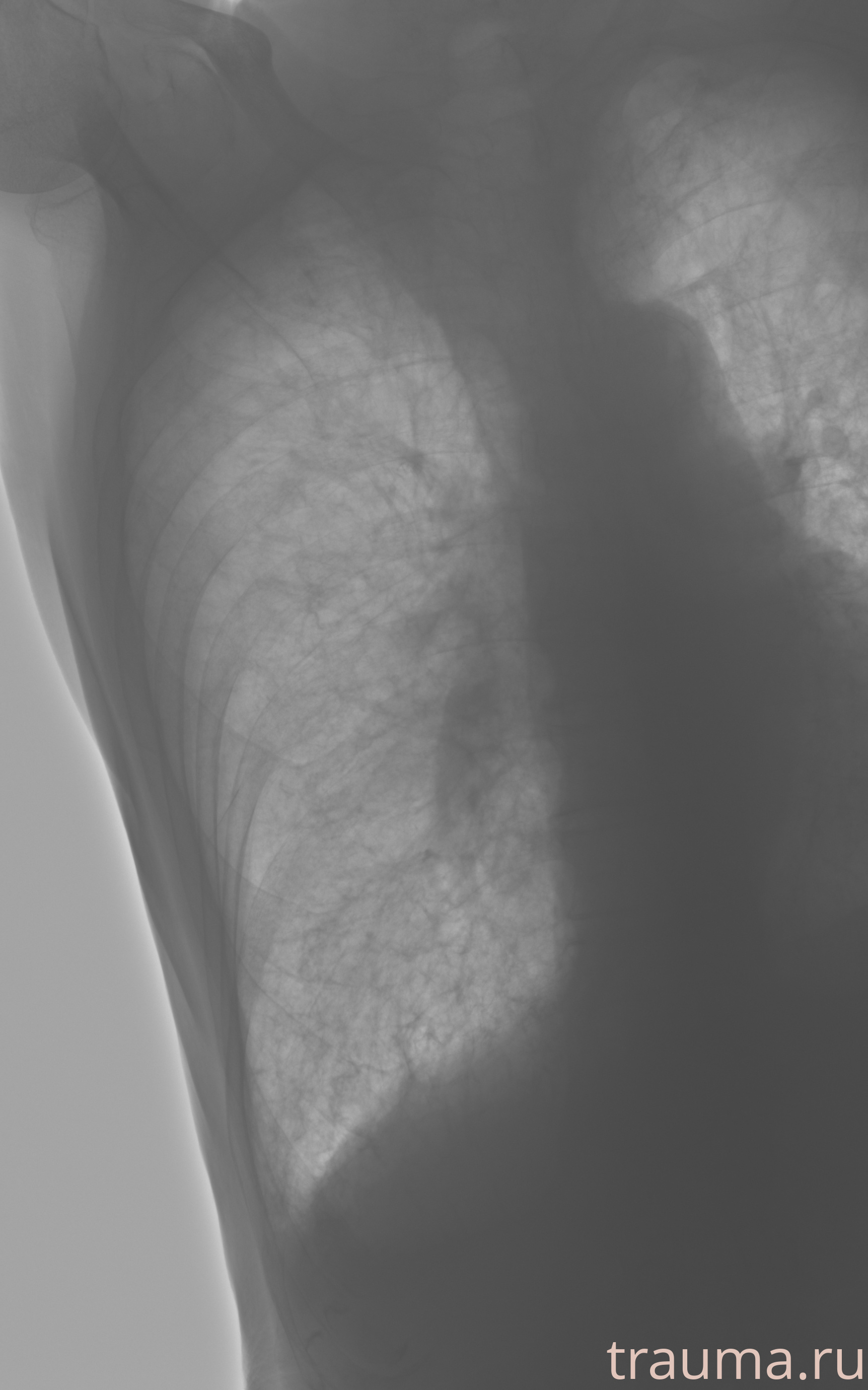 Рентген на дому: по вашему адресу приезжает врач-рентгенолог, травматолог-ортопед с мобильным рентгеновским аппаратом, проводит диагностику травмы или заболевания, делает необходимые рентгенограммы, дает рекомендации по дальнейшему лечению. Получить качественные снимки в домашних условиях возможно благодаря уникальной методике, разработанной МосРентген Центром для института  Склифосовского