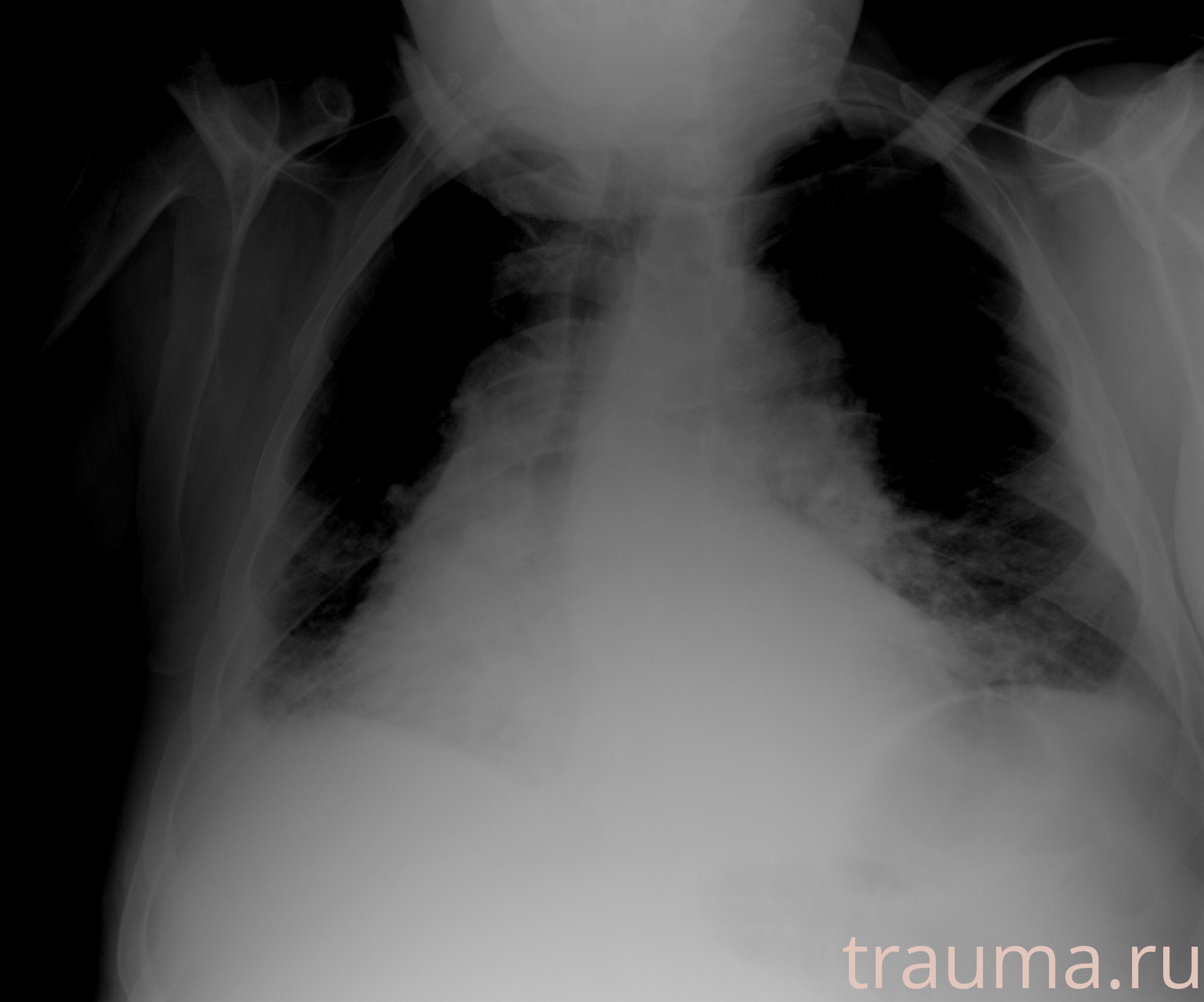 Рентген на дому: по вашему адресу приезжает врач-рентгенолог, травматолог-ортопед с мобильным рентгеновским аппаратом, проводит диагностику травмы или заболевания, делает необходимые рентгенограммы, дает рекомендации по дальнейшему лечению. Получить качественные снимки в домашних условиях возможно благодаря уникальной методике, разработанной МосРентген Центром для института  Склифосовского