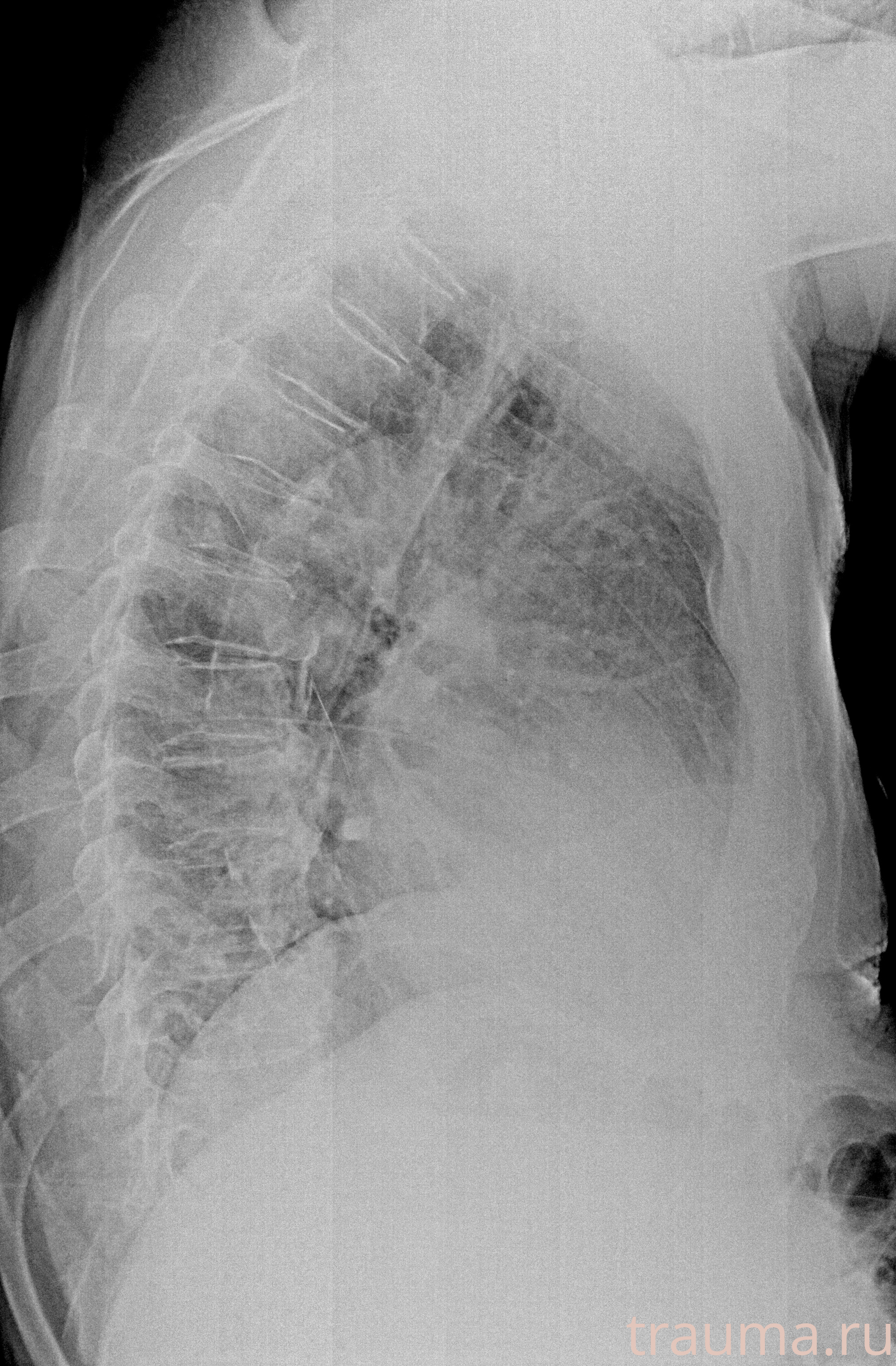 Рентген на дому: по вашему адресу приезжает врач-рентгенолог, травматолог-ортопед с мобильным рентгеновским аппаратом, проводит диагностику травмы или заболевания, делает необходимые рентгенограммы, дает рекомендации по дальнейшему лечению. Получить качественные снимки в домашних условиях возможно благодаря уникальной методике, разработанной МосРентген Центром для института  Склифосовского