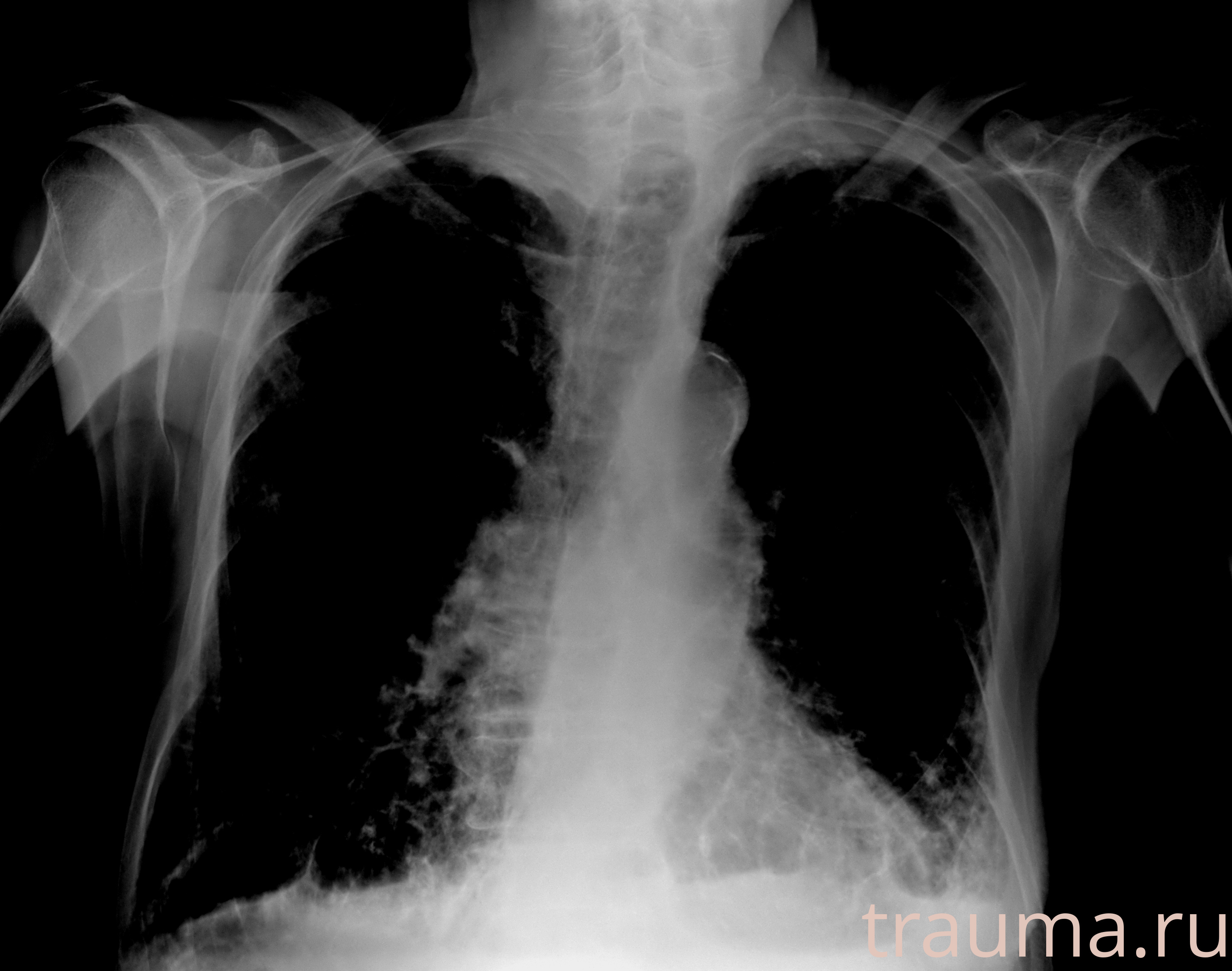 Рентген на дому: по вашему адресу приезжает врач-рентгенолог, травматолог-ортопед с мобильным рентгеновским аппаратом, проводит диагностику травмы или заболевания, делает необходимые рентгенограммы, дает рекомендации по дальнейшему лечению. Получить качественные снимки в домашних условиях возможно благодаря уникальной методике, разработанной МосРентген Центром для института  Склифосовского
