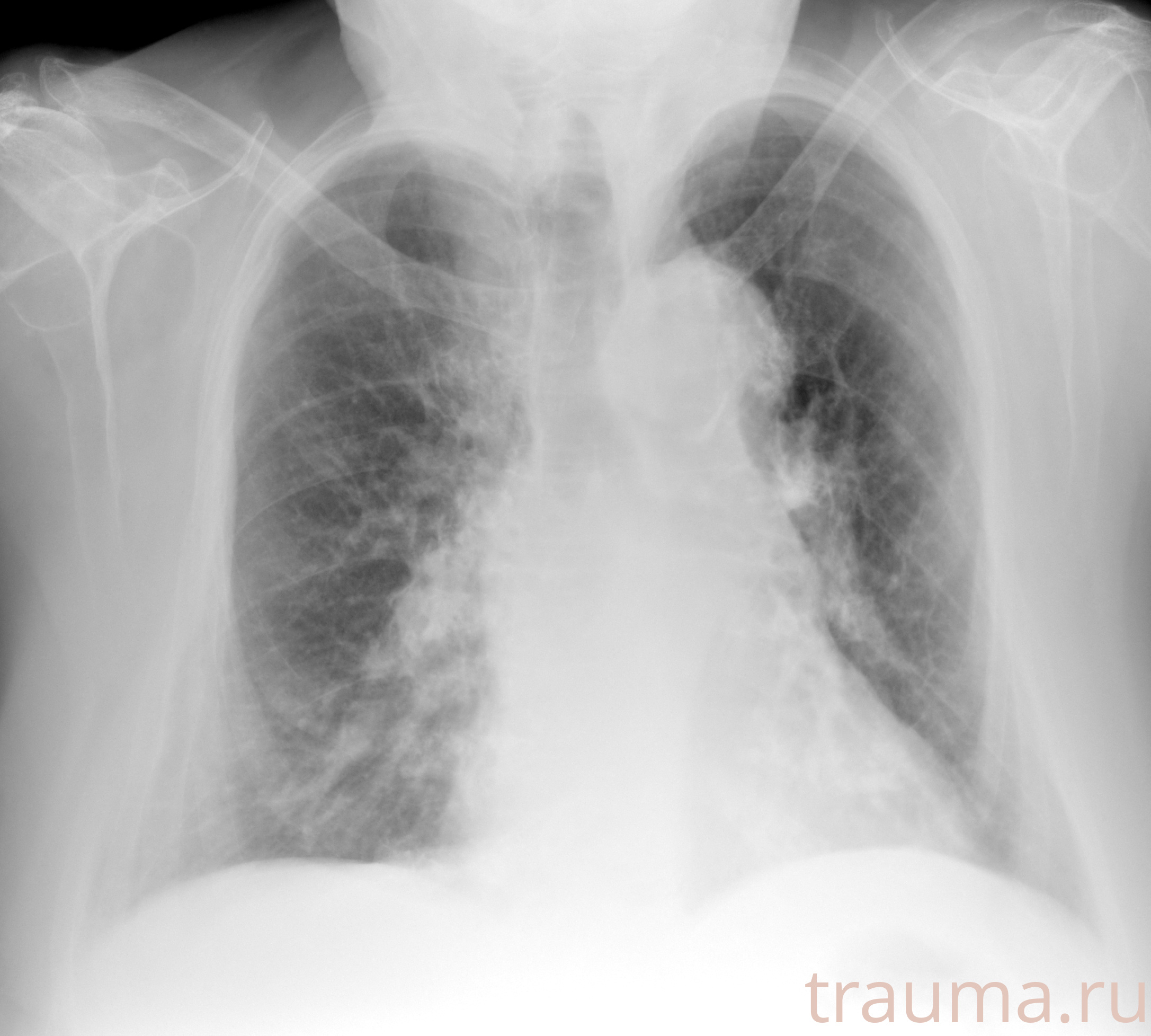 Рентген на дому: по вашему адресу приезжает врач-рентгенолог, травматолог-ортопед с мобильным рентгеновским аппаратом, проводит диагностику травмы или заболевания, делает необходимые рентгенограммы, дает рекомендации по дальнейшему лечению. Получить качественные снимки в домашних условиях возможно благодаря уникальной методике, разработанной МосРентген Центром для института  Склифосовского