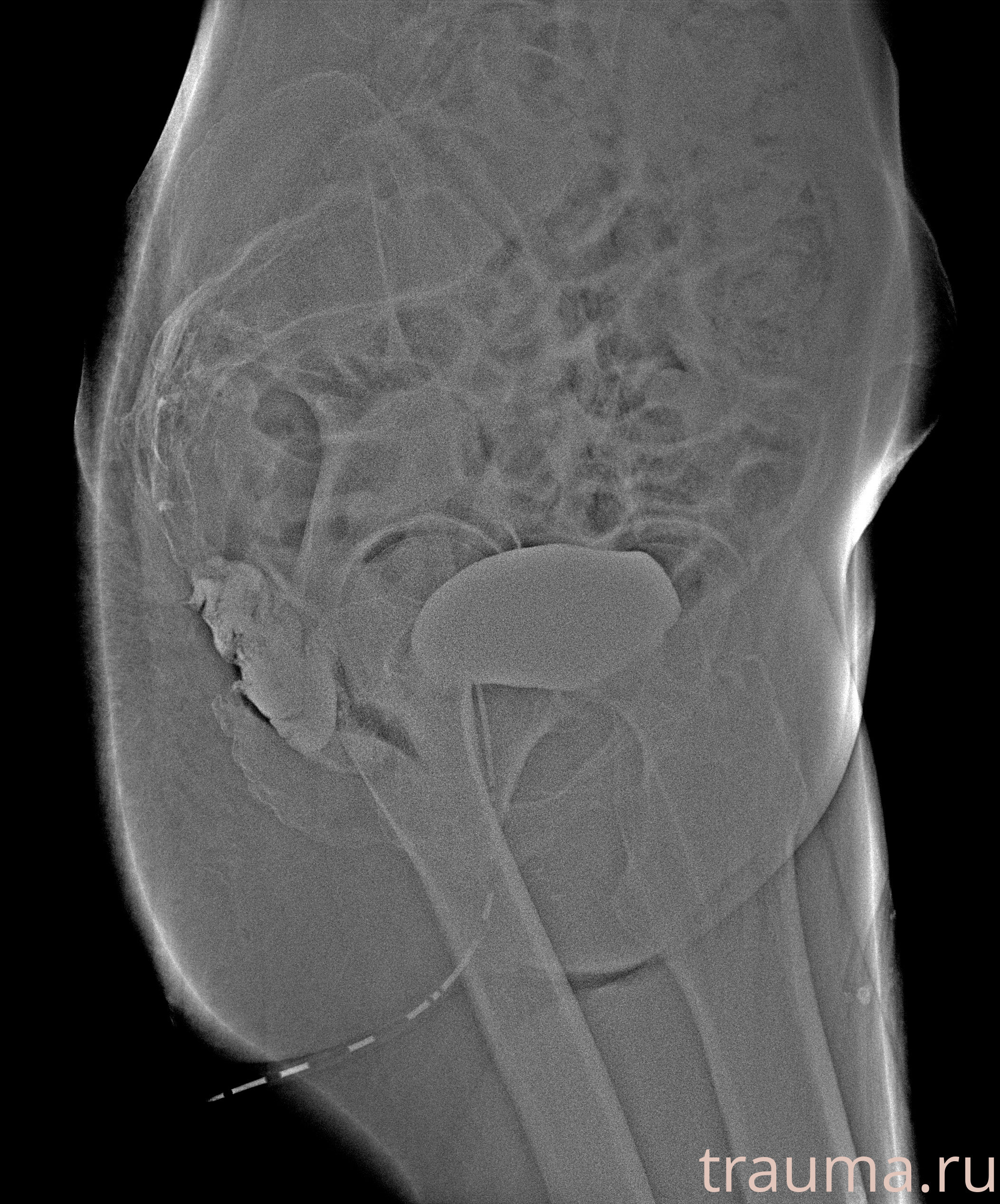 Рентген на дому: по вашему адресу приезжает врач-рентгенолог, травматолог-ортопед с мобильным рентгеновским аппаратом, проводит диагностику травмы или заболевания, делает необходимые рентгенограммы, дает рекомендации по дальнейшему лечению. Получить качественные снимки в домашних условиях возможно благодаря уникальной методике, разработанной МосРентген Центром для института  Склифосовского