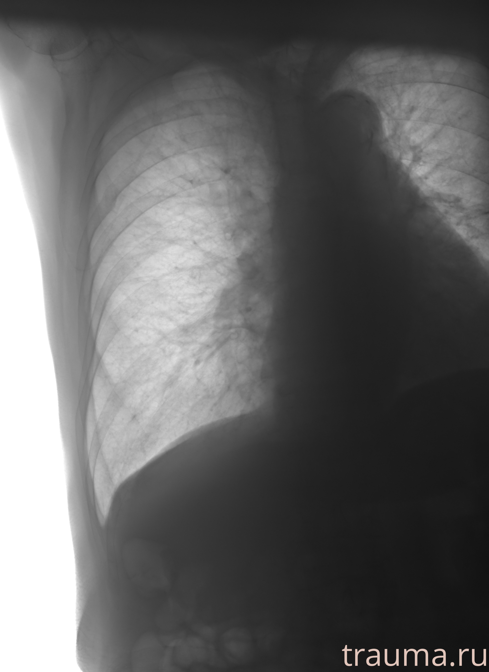 Рентген на дому: по вашему адресу приезжает врач-рентгенолог, травматолог-ортопед с мобильным рентгеновским аппаратом, проводит диагностику травмы или заболевания, делает необходимые рентгенограммы, дает рекомендации по дальнейшему лечению. Получить качественные снимки в домашних условиях возможно благодаря уникальной методике, разработанной МосРентген Центром для института  Склифосовского