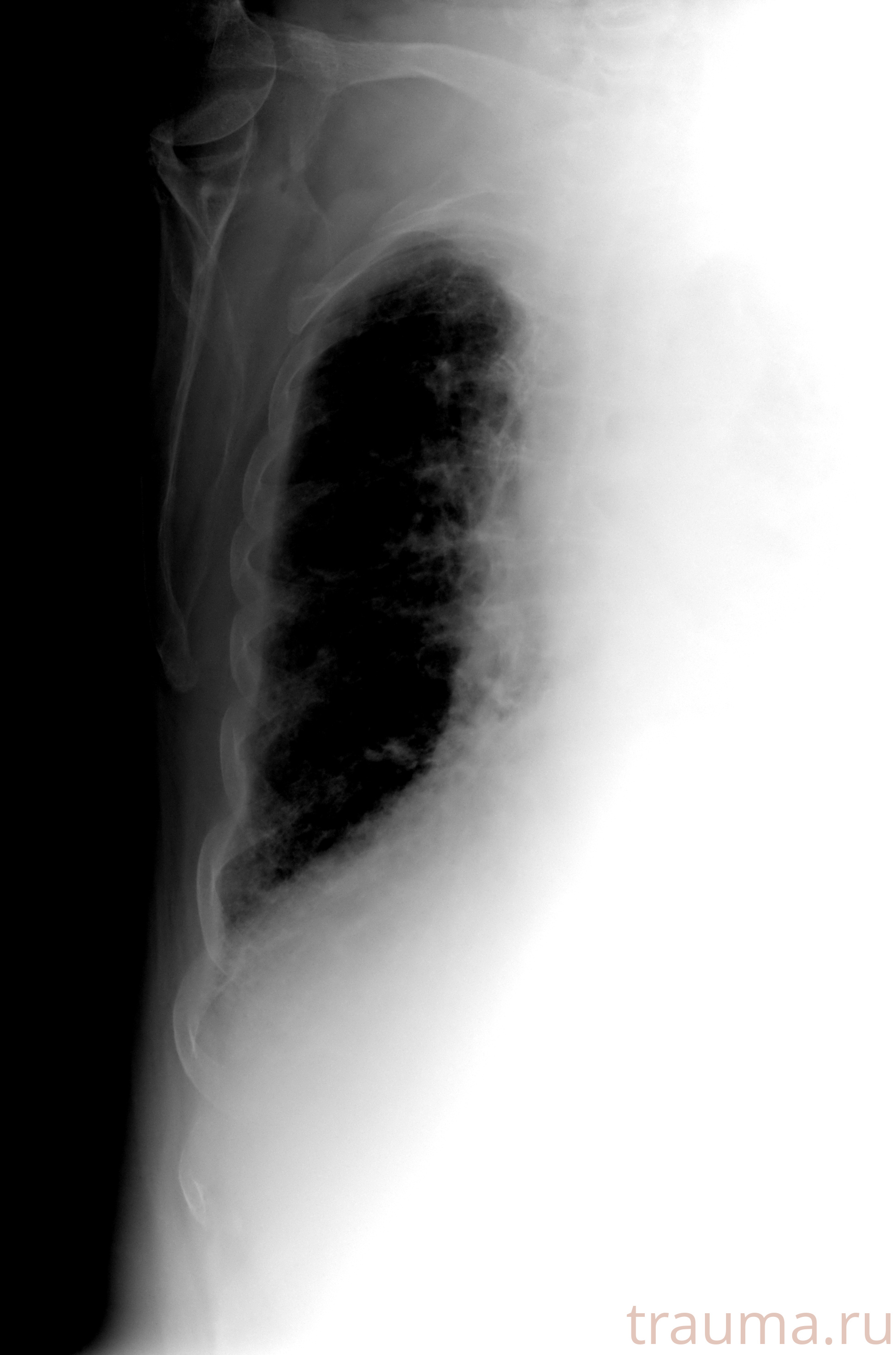 Рентген на дому: по вашему адресу приезжает врач-рентгенолог, травматолог-ортопед с мобильным рентгеновским аппаратом, проводит диагностику травмы или заболевания, делает необходимые рентгенограммы, дает рекомендации по дальнейшему лечению. Получить качественные снимки в домашних условиях возможно благодаря уникальной методике, разработанной МосРентген Центром для института  Склифосовского