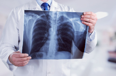 Врачи не способны отличить сгенерированные ИИ рентгены от настоящих
