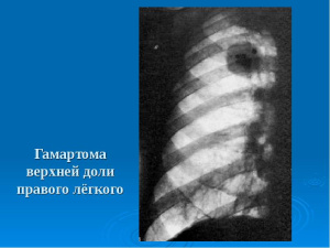Рентген на дому Рентген на дому