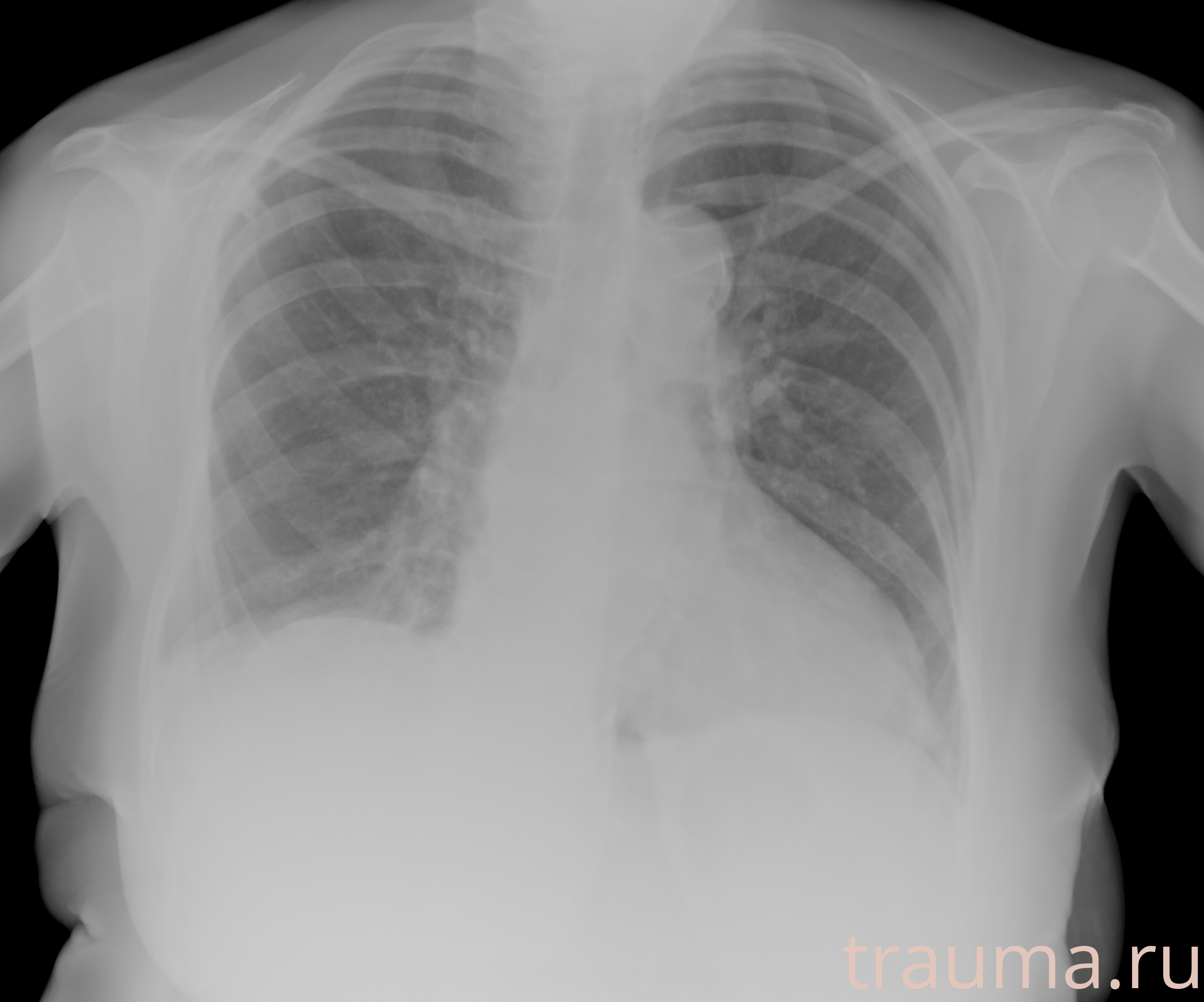 Рентген на дому: по вашему адресу приезжает врач-рентгенолог, травматолог-ортопед с мобильным рентгеновским аппаратом, проводит диагностику травмы или заболевания, делает необходимые рентгенограммы, дает рекомендации по дальнейшему лечению. Получить качественные снимки в домашних условиях возможно благодаря уникальной методике, разработанной МосРентген Центром для института  Склифосовского
