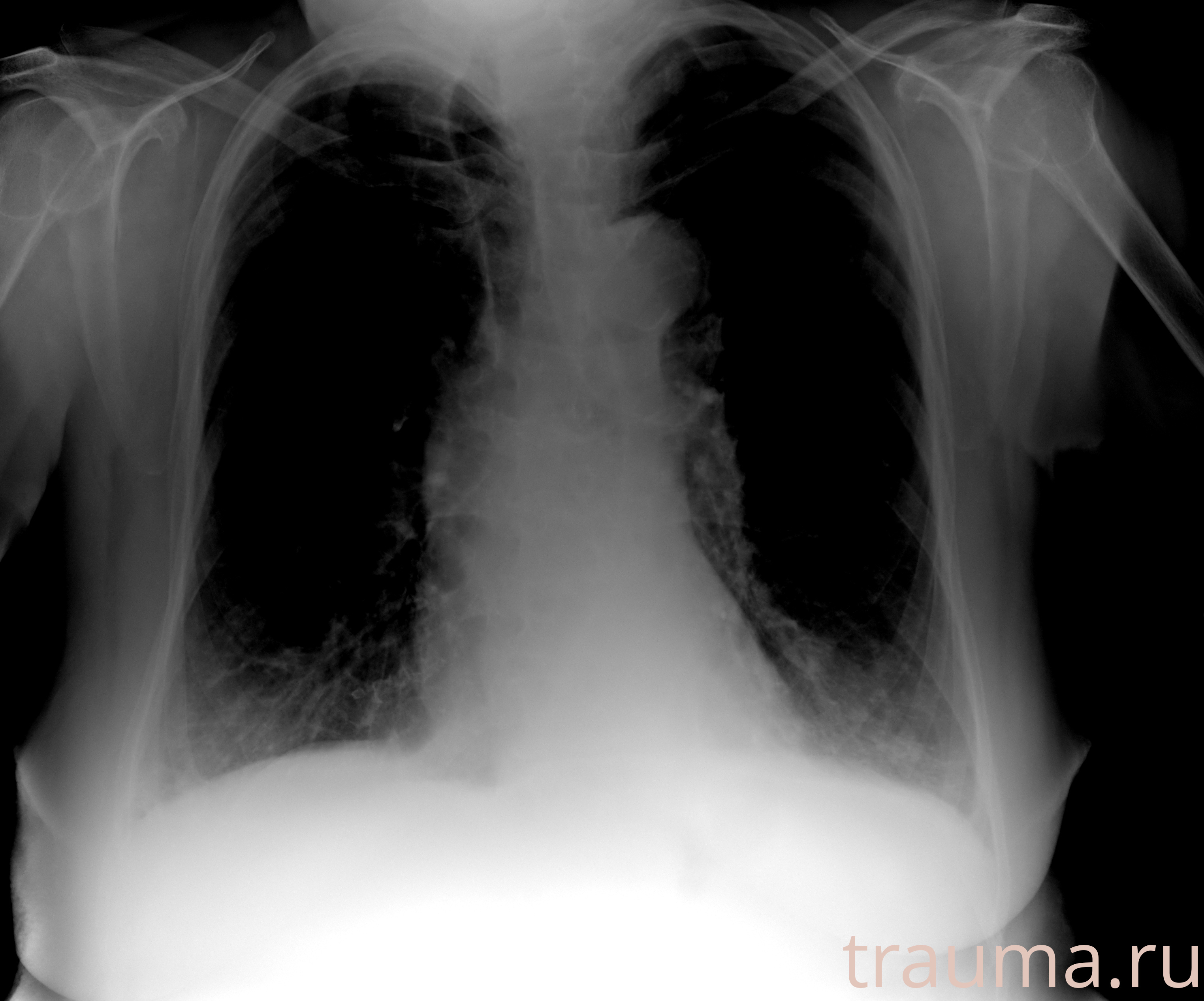 Рентген на дому: по вашему адресу приезжает врач-рентгенолог, травматолог-ортопед с мобильным рентгеновским аппаратом, проводит диагностику травмы или заболевания, делает необходимые рентгенограммы, дает рекомендации по дальнейшему лечению. Получить качественные снимки в домашних условиях возможно благодаря уникальной методике, разработанной МосРентген Центром для института  Склифосовского