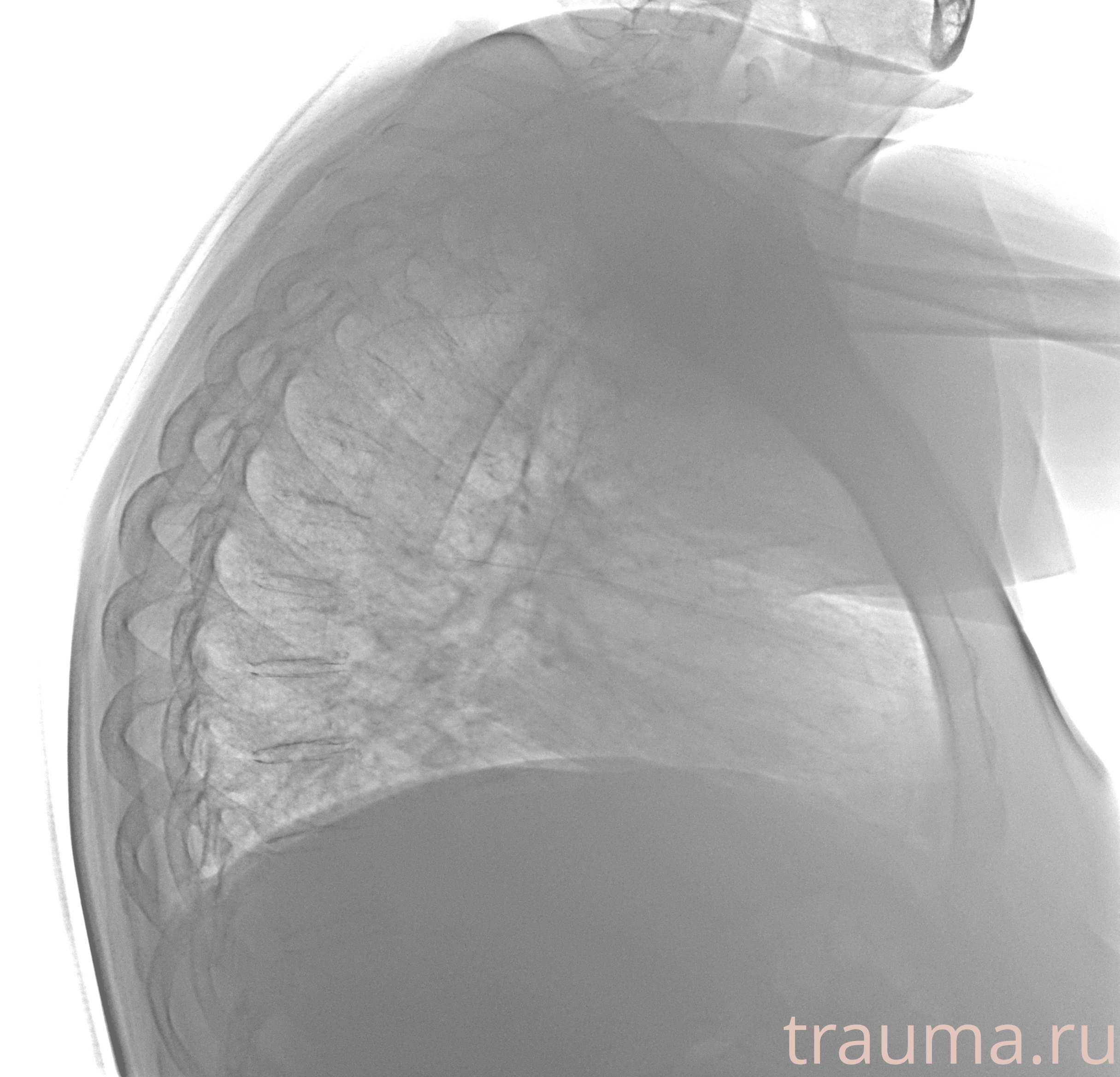 Рентген на дому: по вашему адресу приезжает врач-рентгенолог, травматолог-ортопед с мобильным рентгеновским аппаратом, проводит диагностику травмы или заболевания, делает необходимые рентгенограммы, дает рекомендации по дальнейшему лечению. Получить качественные снимки в домашних условиях возможно благодаря уникальной методике, разработанной МосРентген Центром для института  Склифосовского