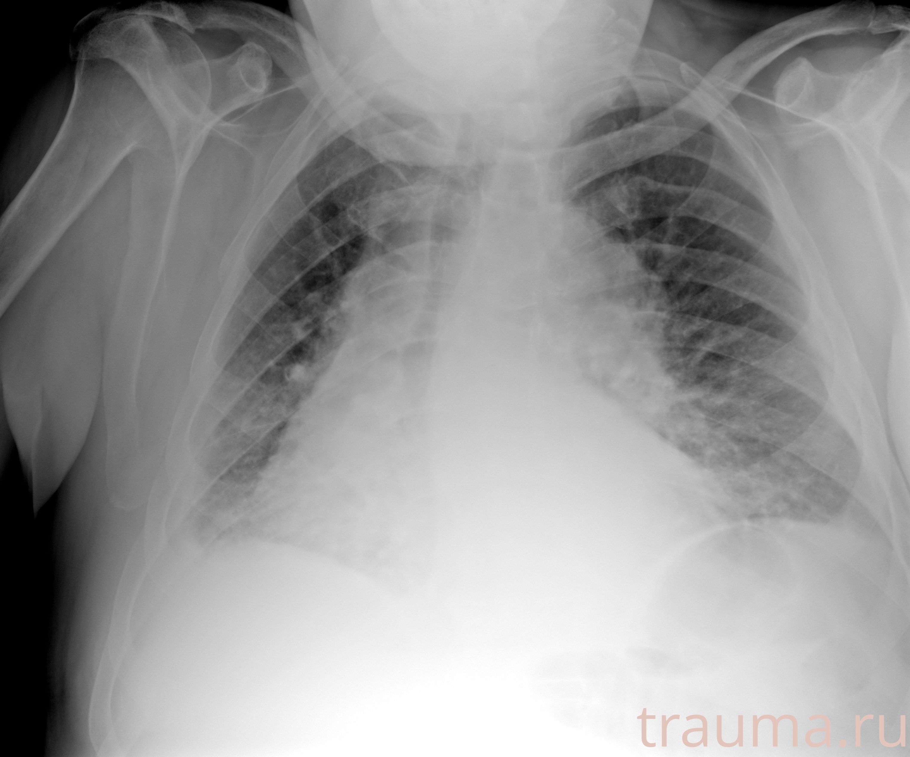 Рентген на дому: по вашему адресу приезжает врач-рентгенолог, травматолог-ортопед с мобильным рентгеновским аппаратом, проводит диагностику травмы или заболевания, делает необходимые рентгенограммы, дает рекомендации по дальнейшему лечению. Получить качественные снимки в домашних условиях возможно благодаря уникальной методике, разработанной МосРентген Центром для института  Склифосовского