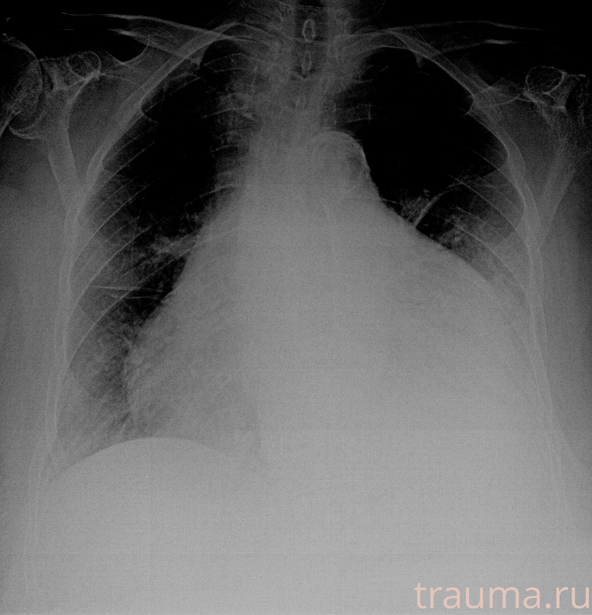 Рентген на дому: по вашему адресу приезжает врач-рентгенолог, травматолог-ортопед с мобильным рентгеновским аппаратом, проводит диагностику травмы или заболевания, делает необходимые рентгенограммы, дает рекомендации по дальнейшему лечению. Получить качественные снимки в домашних условиях возможно благодаря уникальной методике, разработанной МосРентген Центром для института  Склифосовского