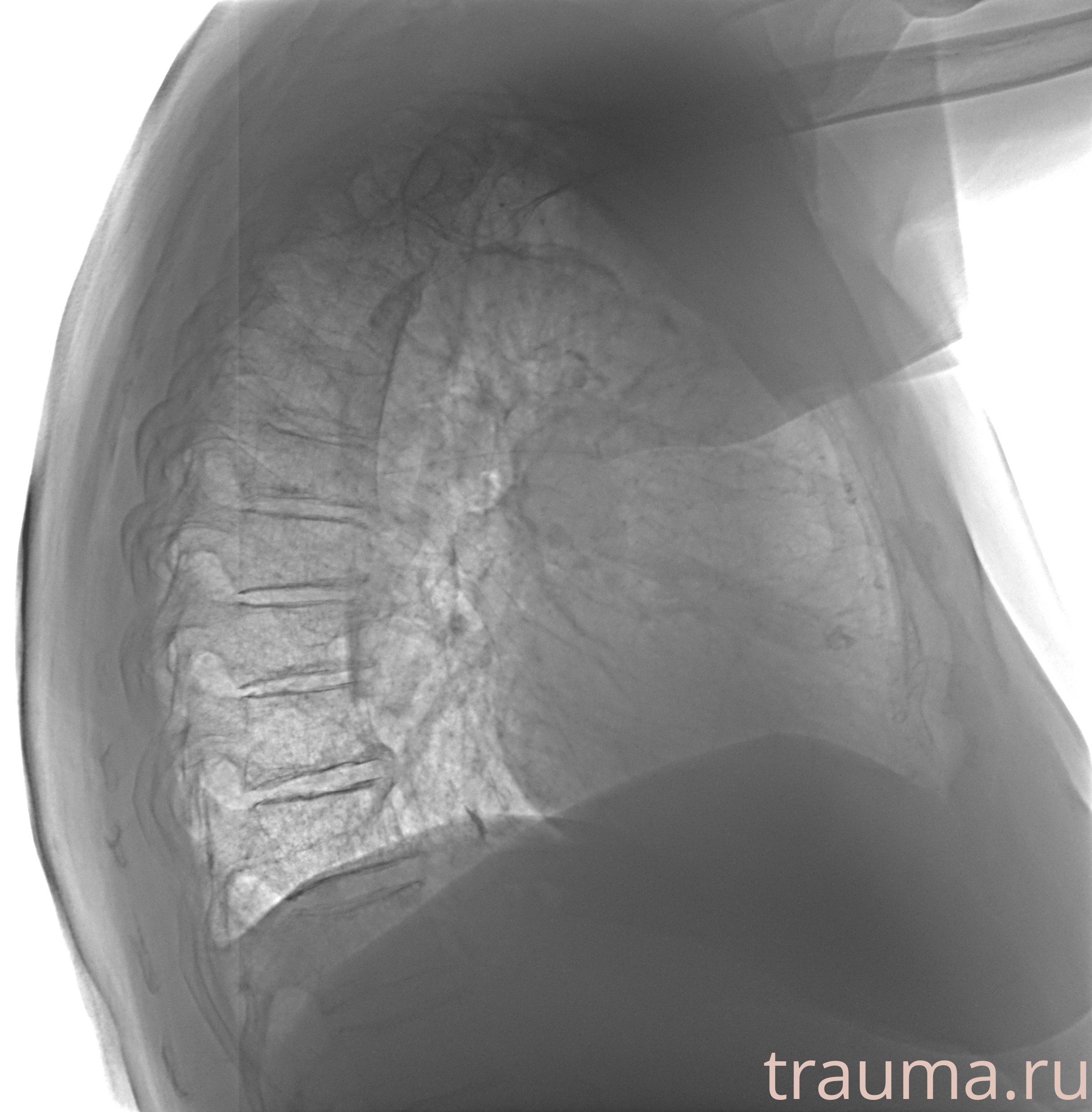 Рентген на дому: по вашему адресу приезжает врач-рентгенолог, травматолог-ортопед с мобильным рентгеновским аппаратом, проводит диагностику травмы или заболевания, делает необходимые рентгенограммы, дает рекомендации по дальнейшему лечению. Получить качественные снимки в домашних условиях возможно благодаря уникальной методике, разработанной МосРентген Центром для института  Склифосовского