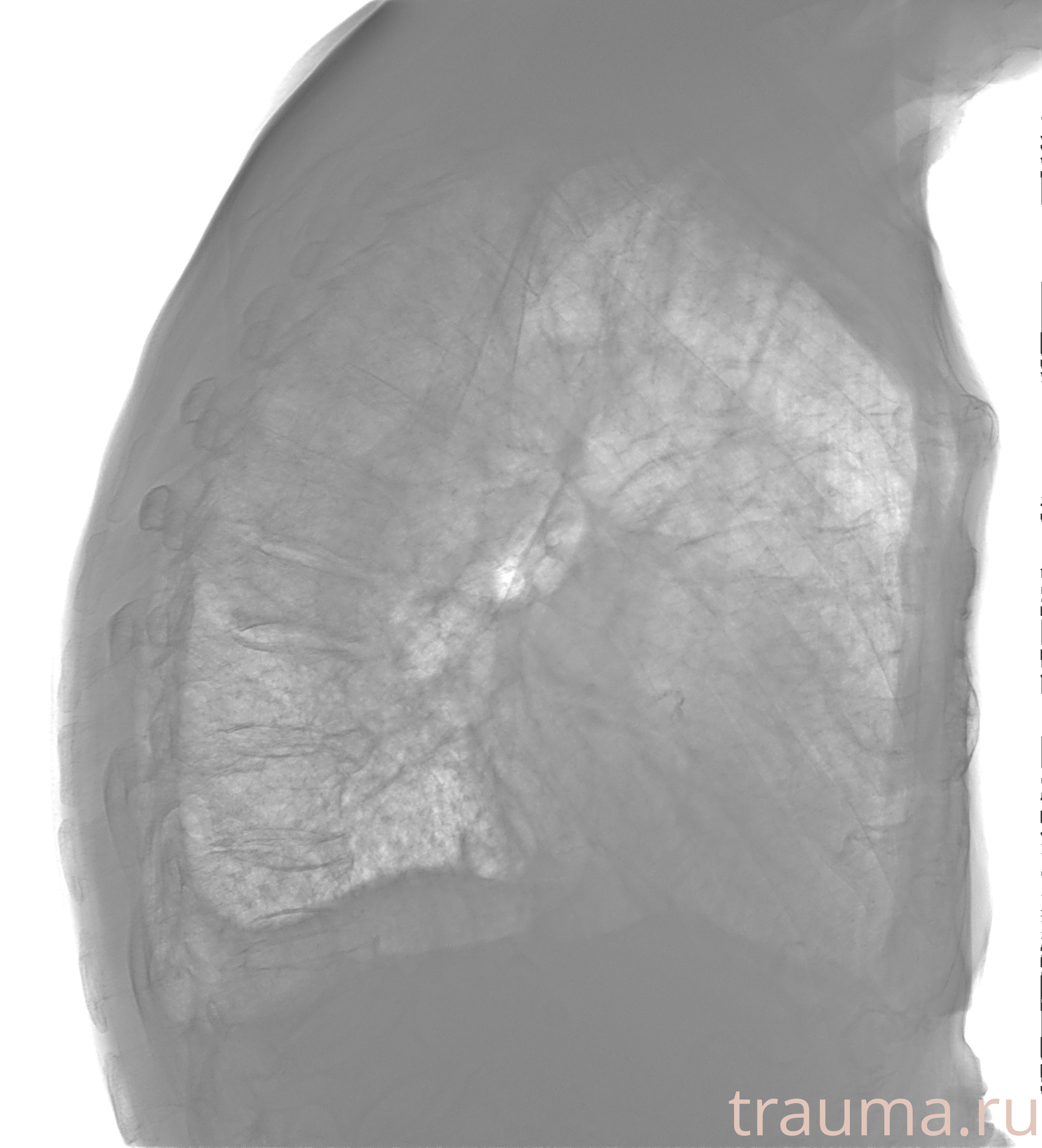 Рентген на дому: по вашему адресу приезжает врач-рентгенолог, травматолог-ортопед с мобильным рентгеновским аппаратом, проводит диагностику травмы или заболевания, делает необходимые рентгенограммы, дает рекомендации по дальнейшему лечению. Получить качественные снимки в домашних условиях возможно благодаря уникальной методике, разработанной МосРентген Центром для института  Склифосовского